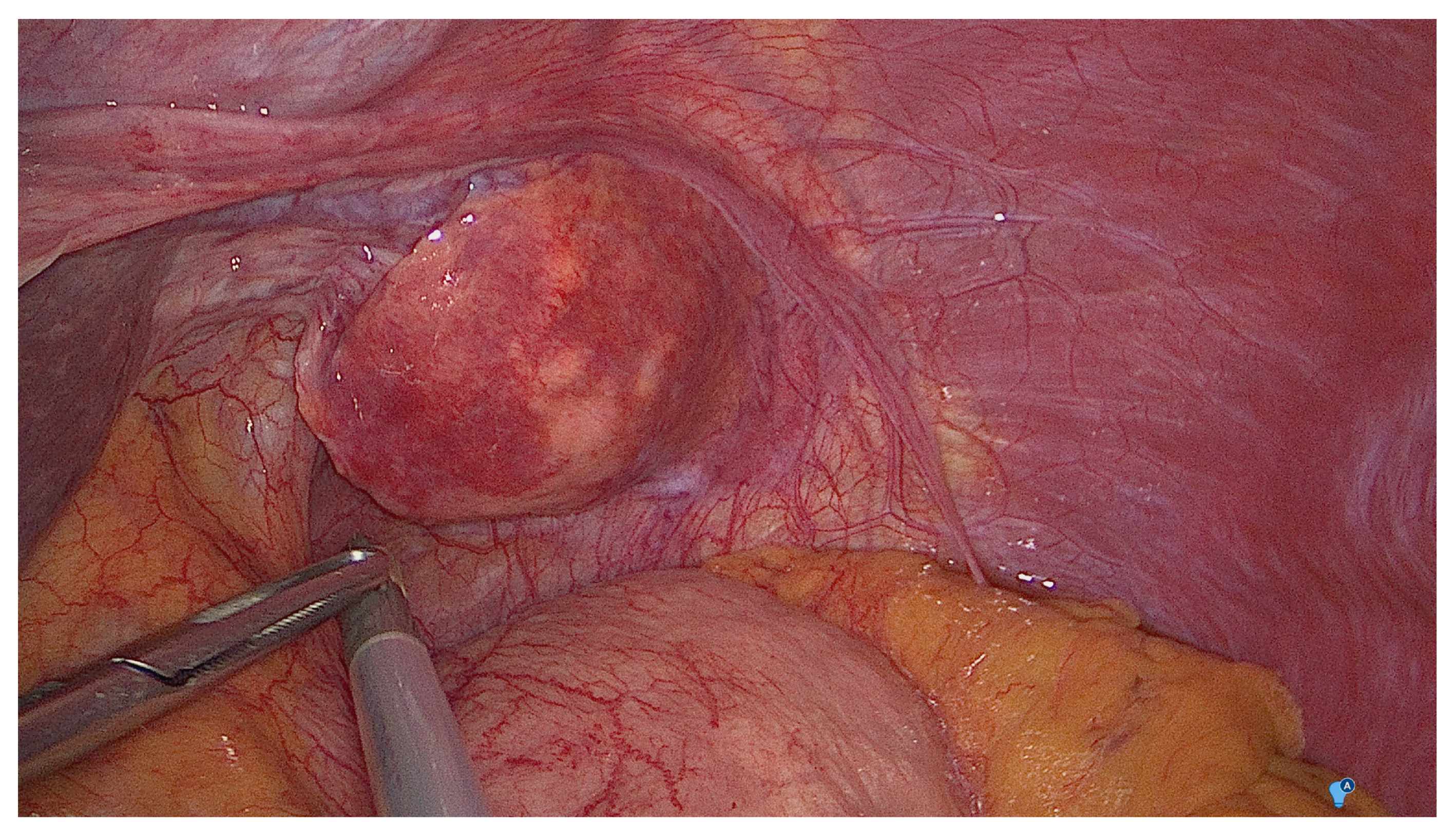 Medicina 57 00850 g002 Medicina 57 00850 g002