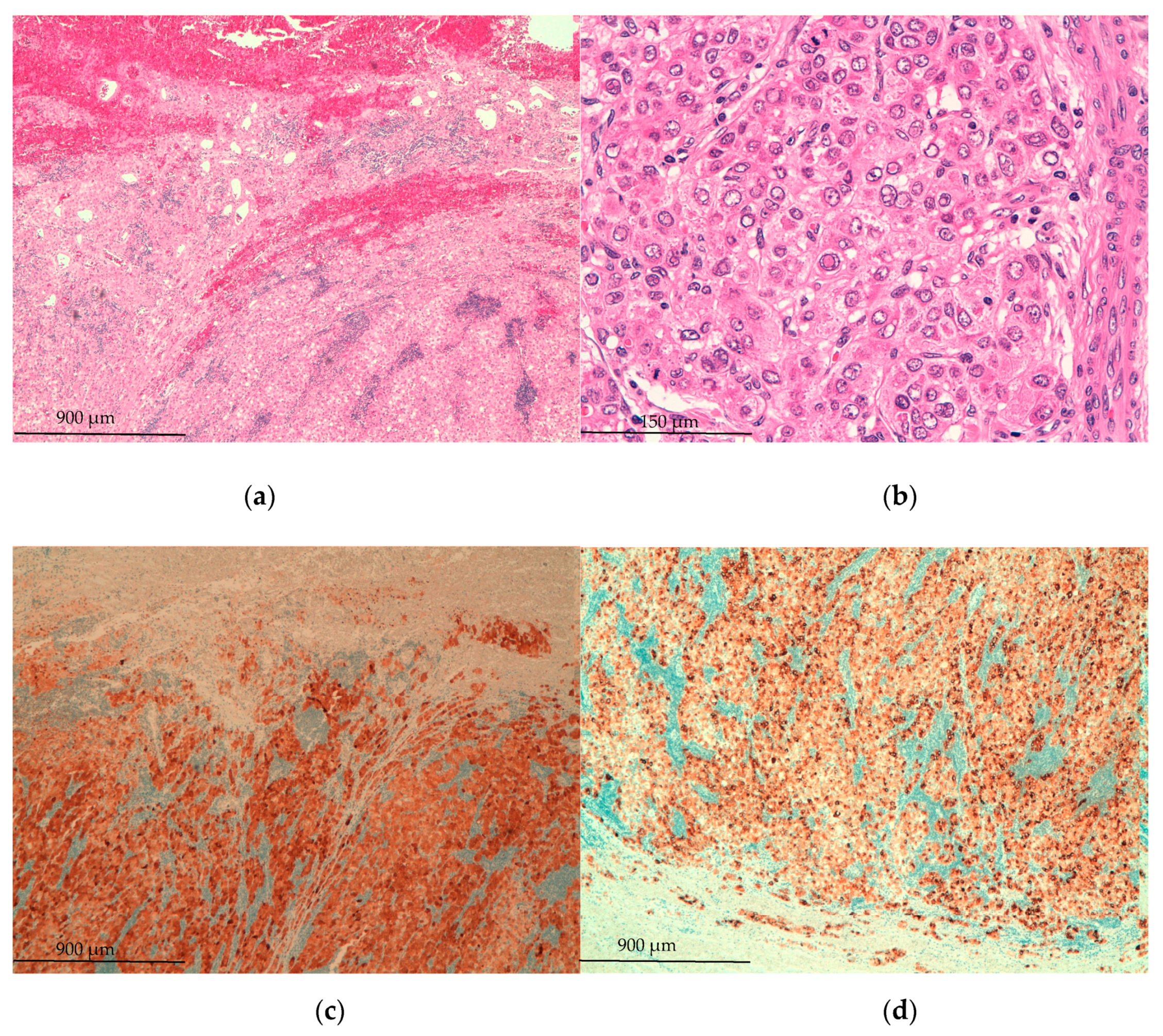 Medicina 57 00850 g003a Medicina 57 00850 g003a