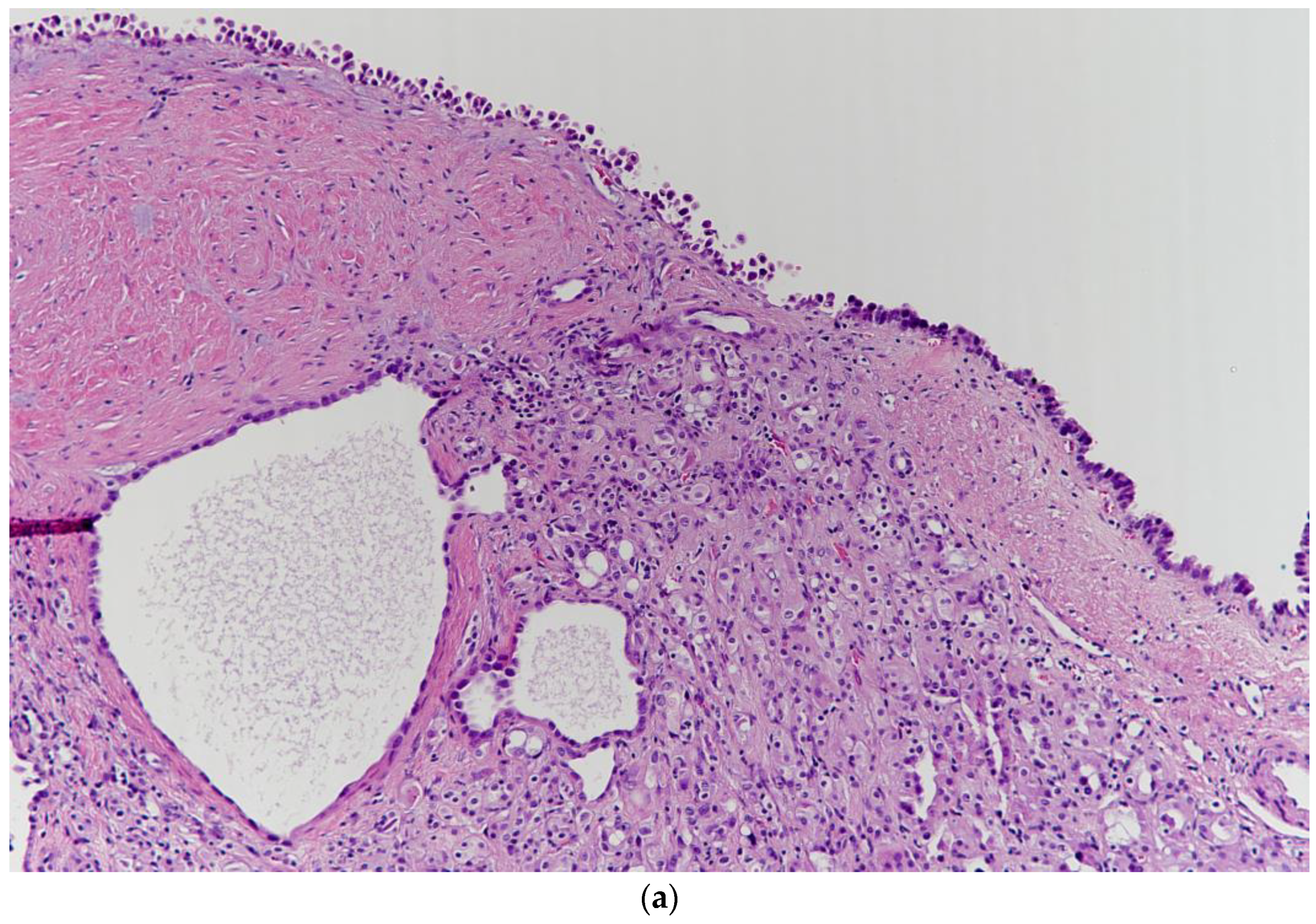 Medicina 57 00851 g003a
