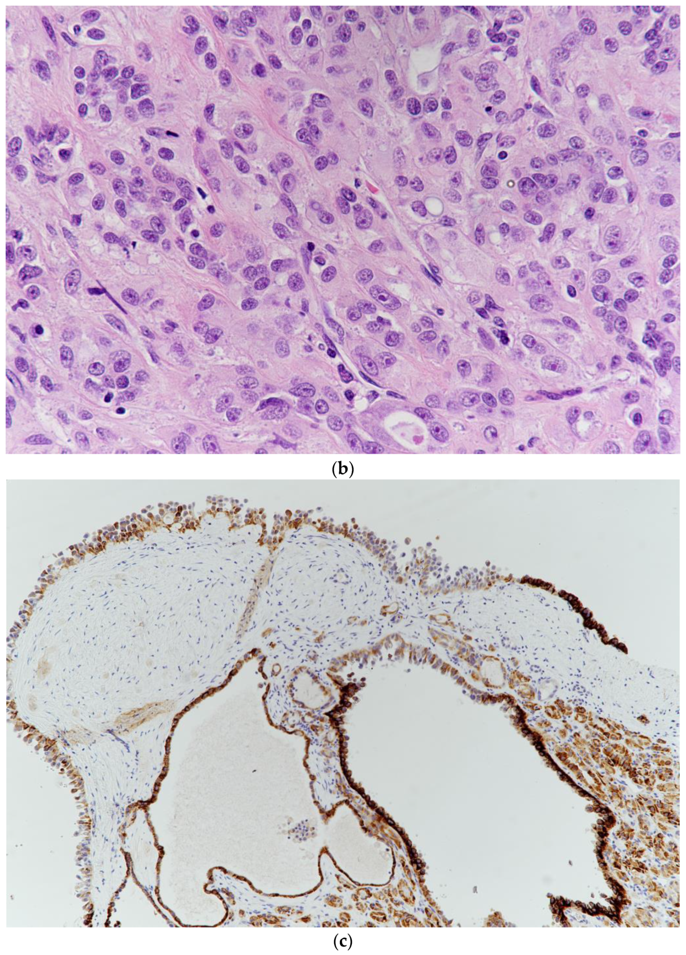 Medicina 57 00851 g003b