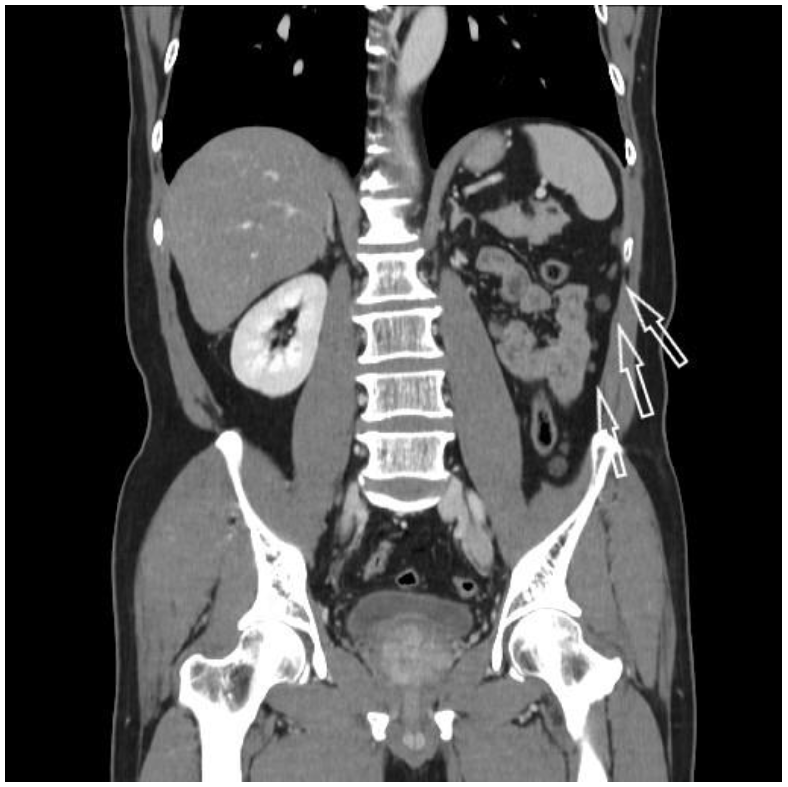 Medicina 57 00851 g004