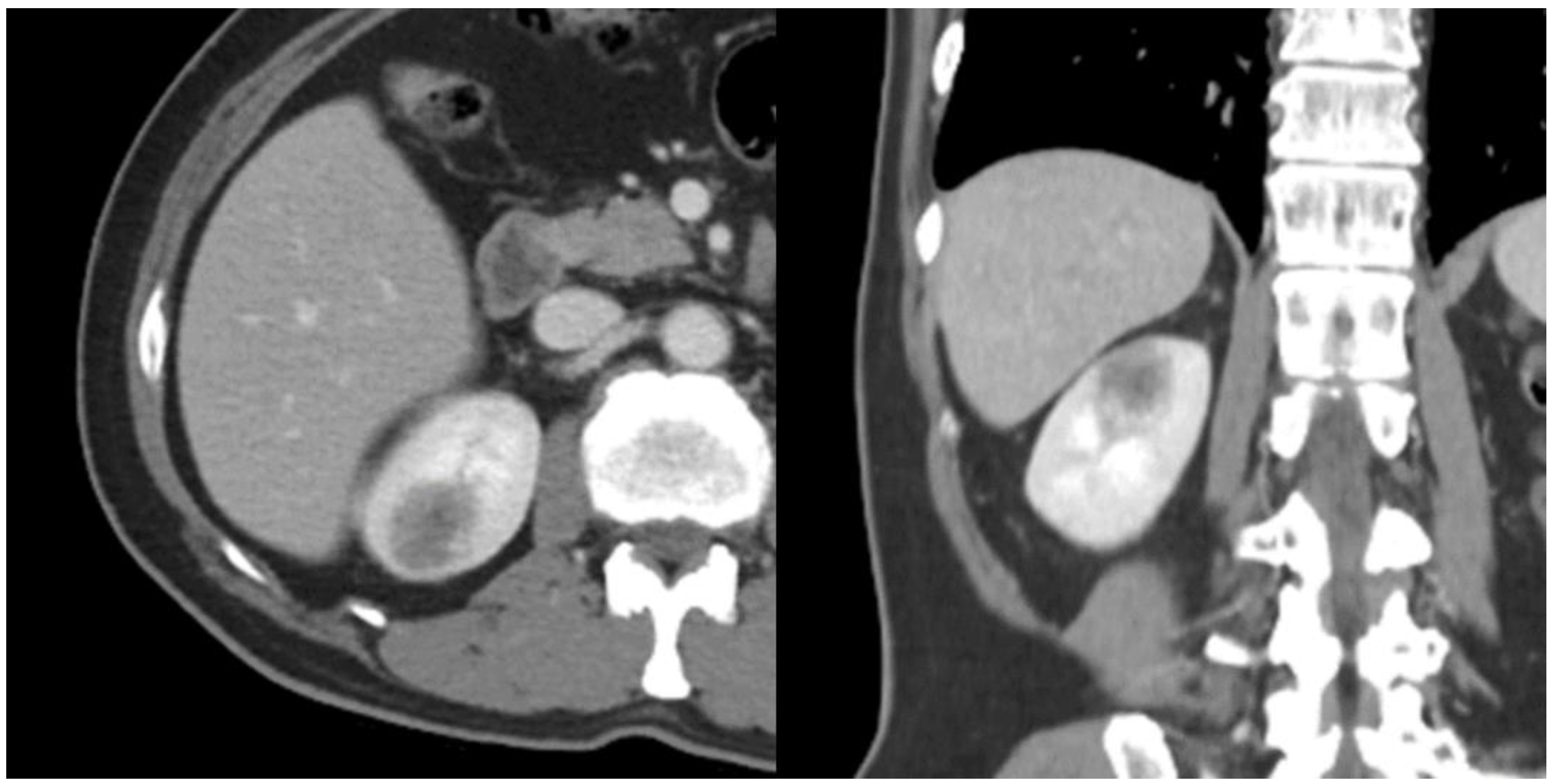 Medicina 57 00851 g005