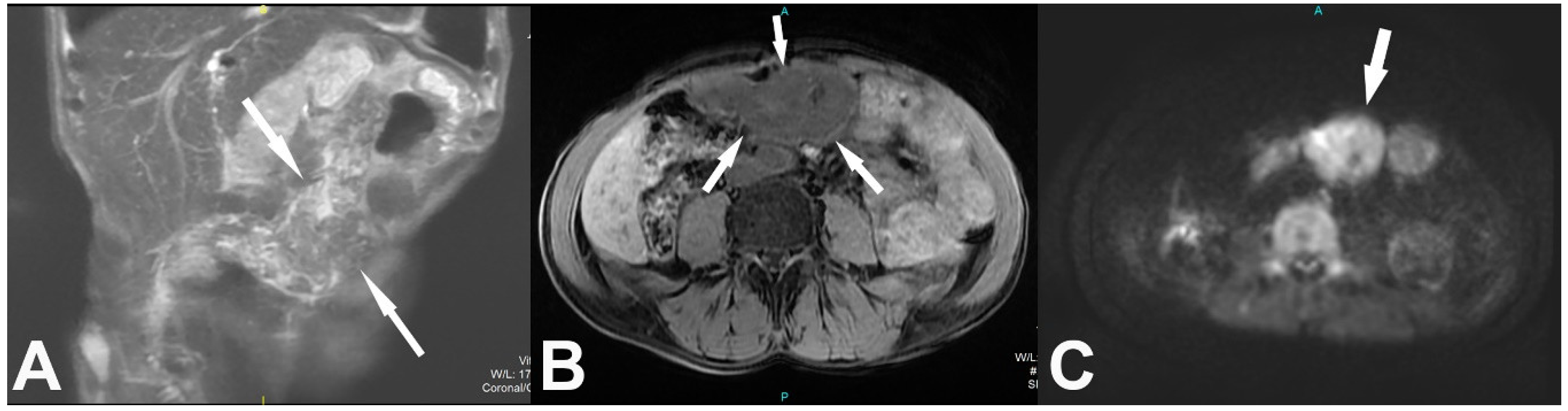 Medicina 57 00865 g002 550