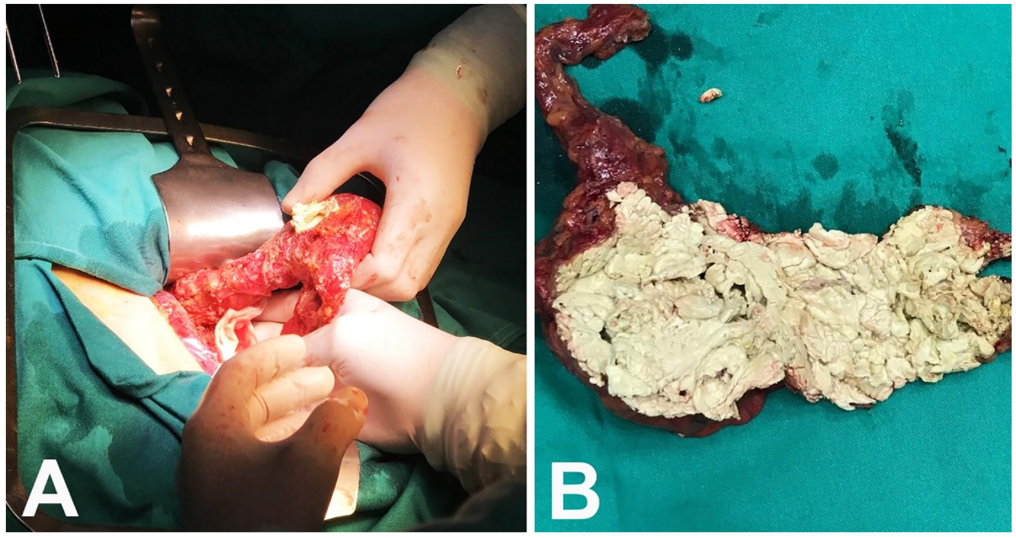 Medicina 57 00865 g003 550