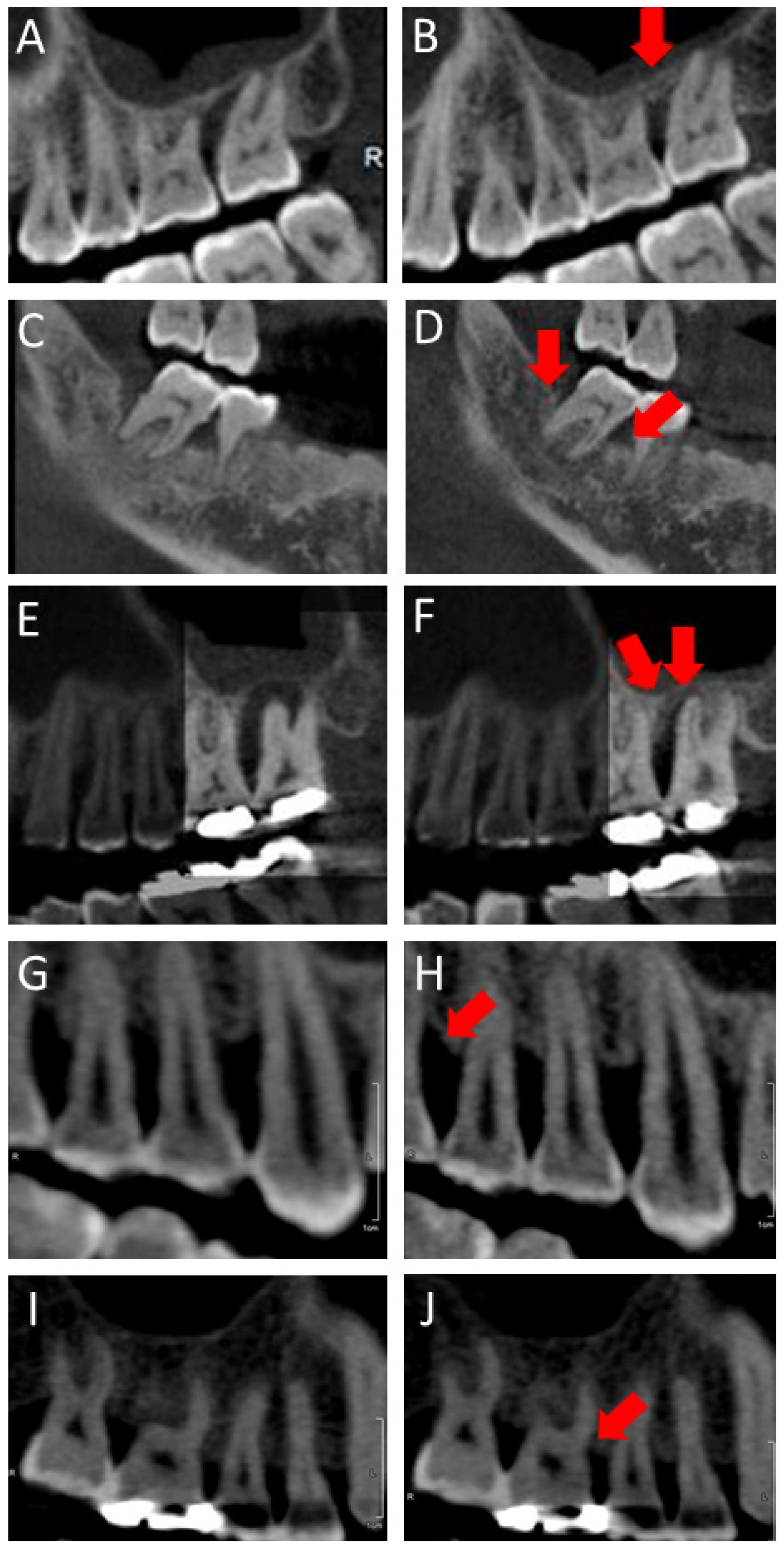 Medicina 57 00869 g004