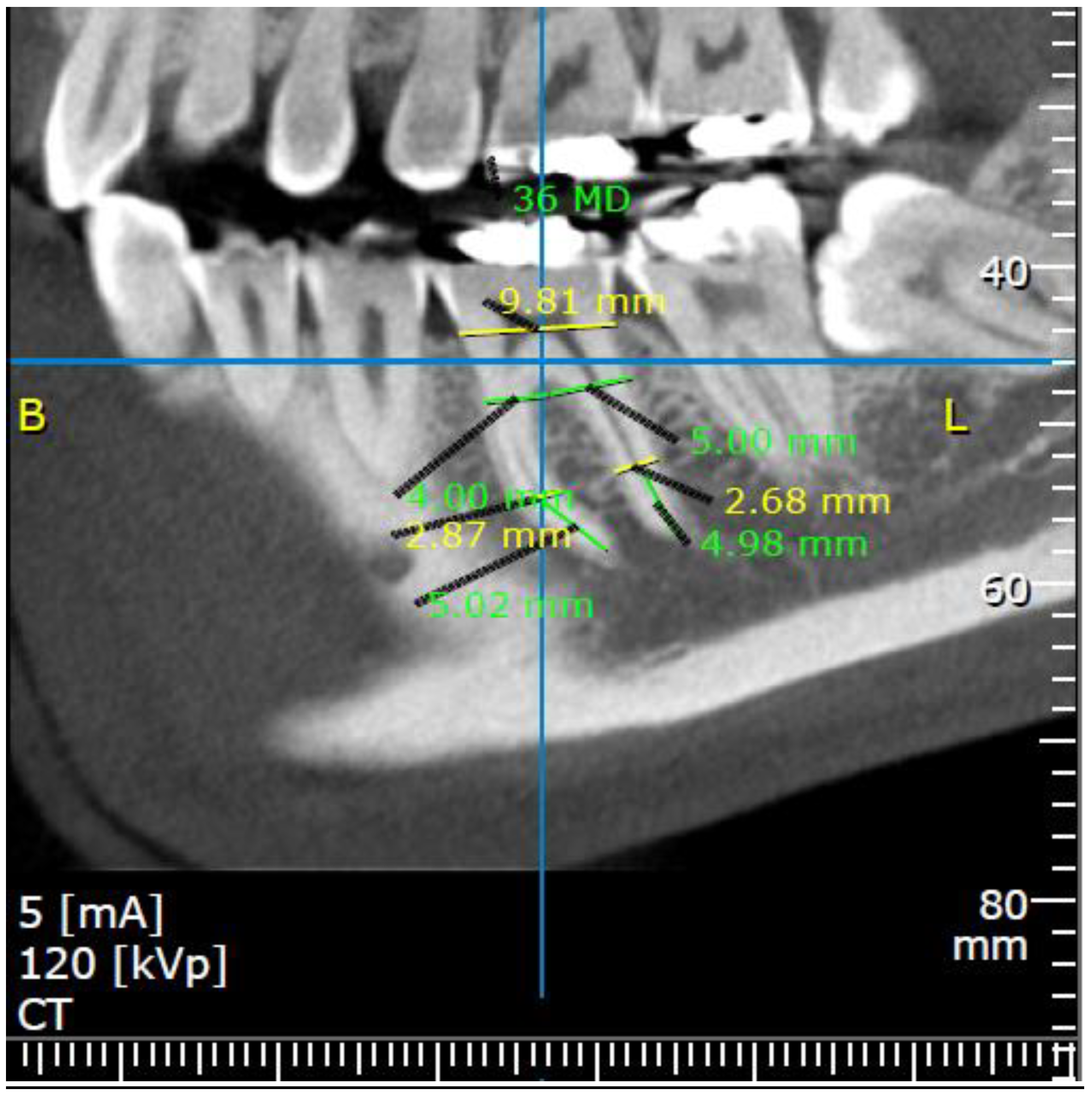 Medicina 57 00874 g002