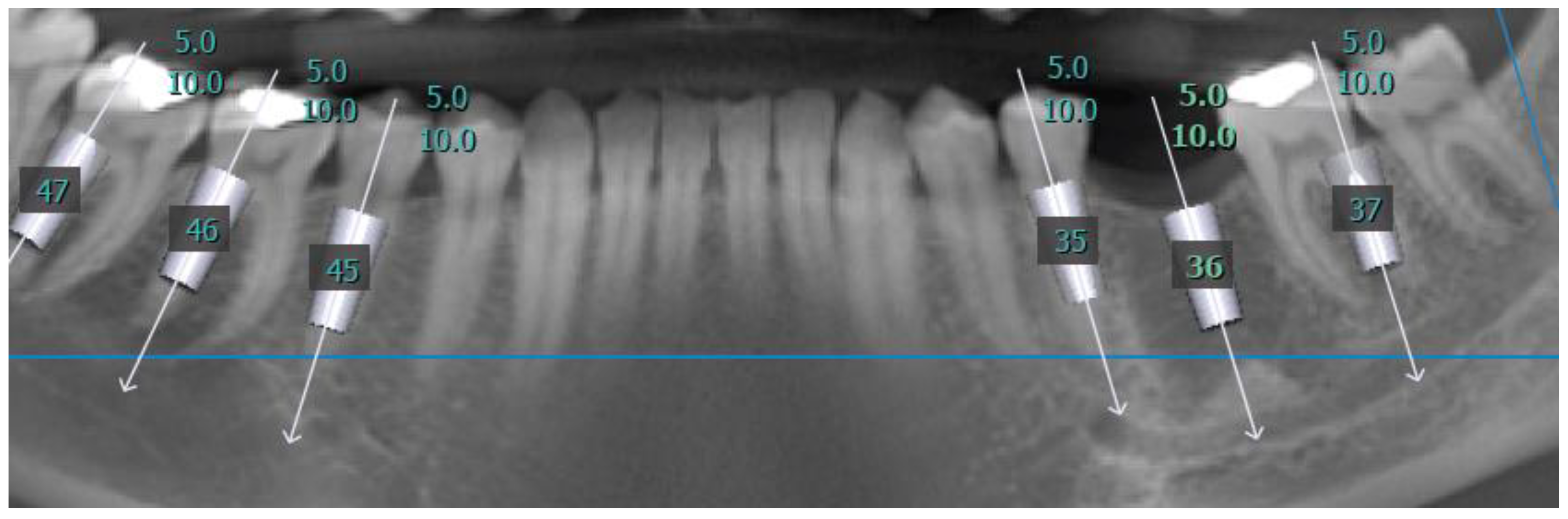 Medicina 57 00874 g004