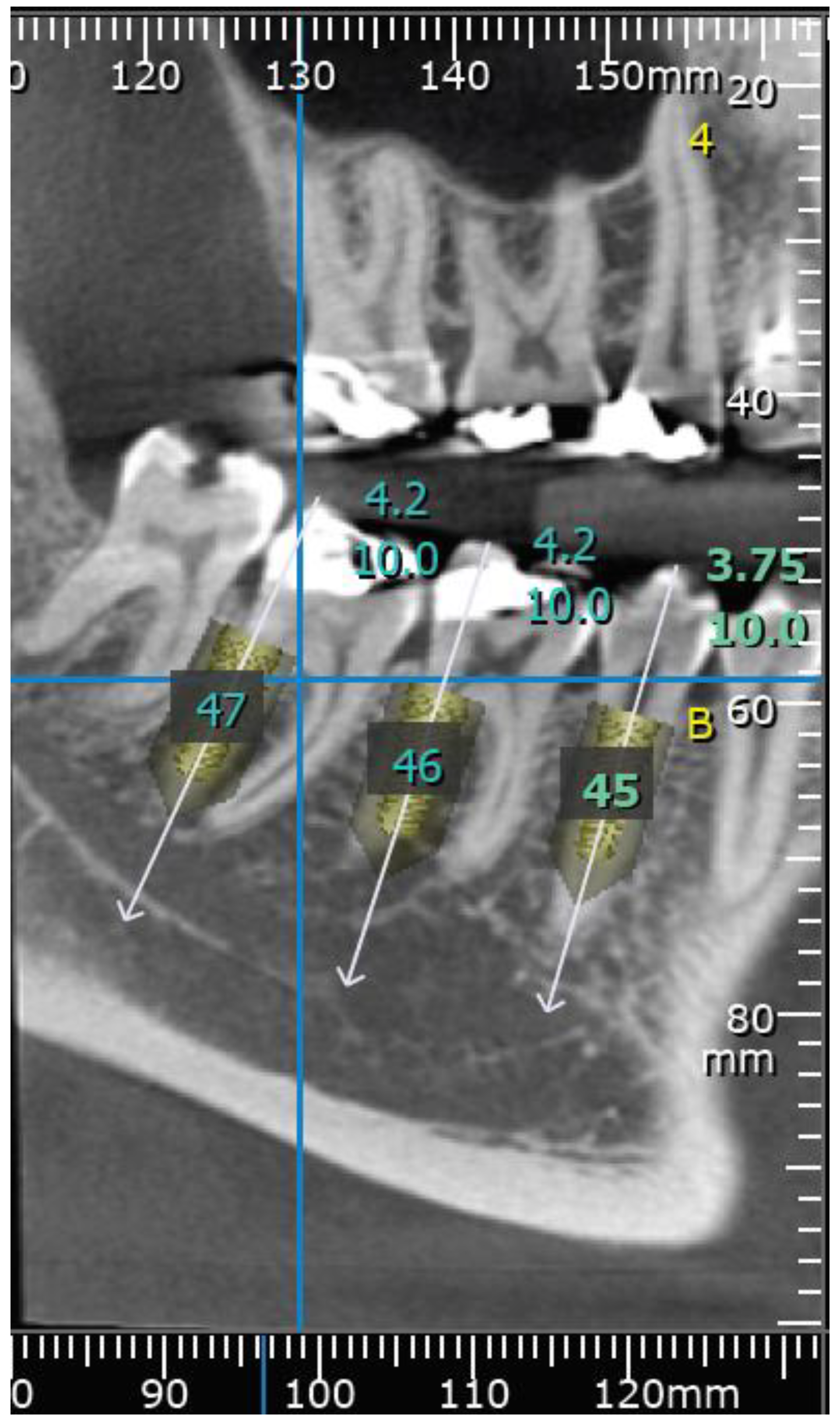 Medicina 57 00874 g005