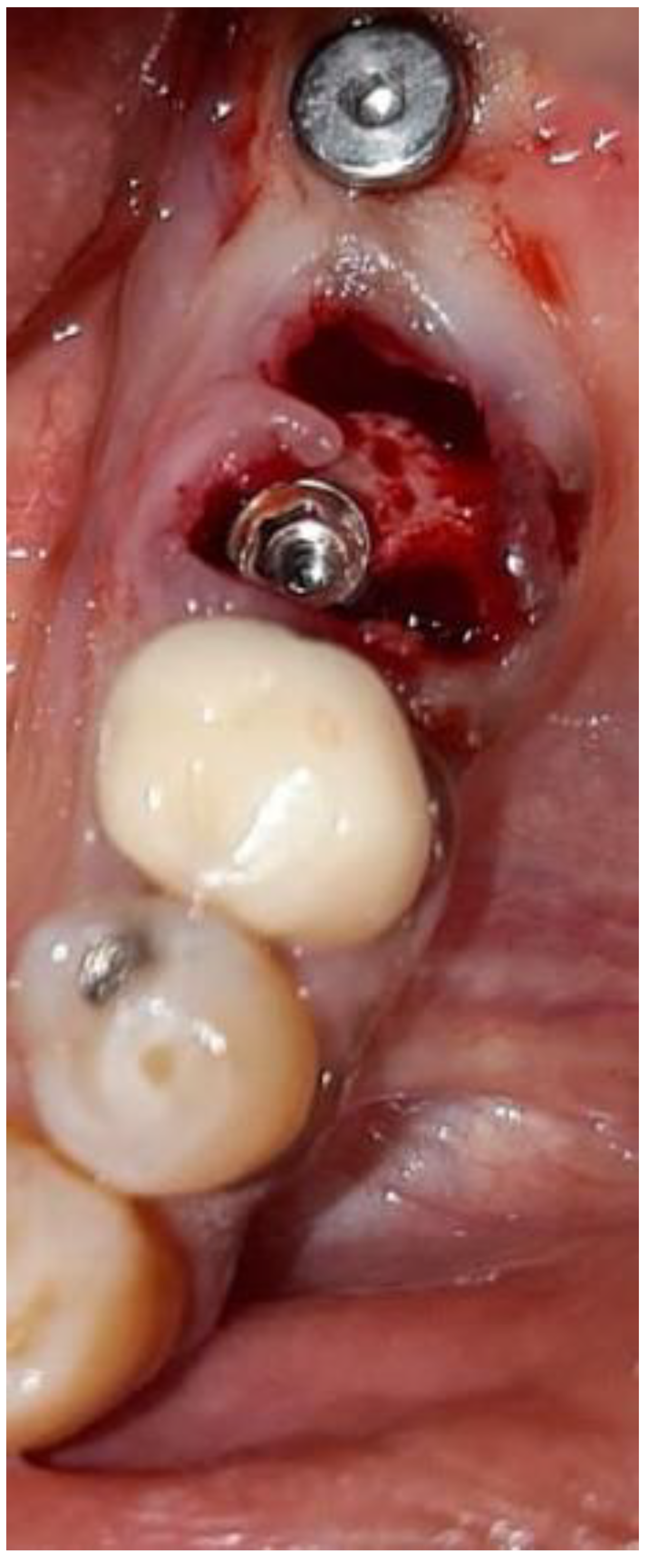 Medicina 57 00874 g006