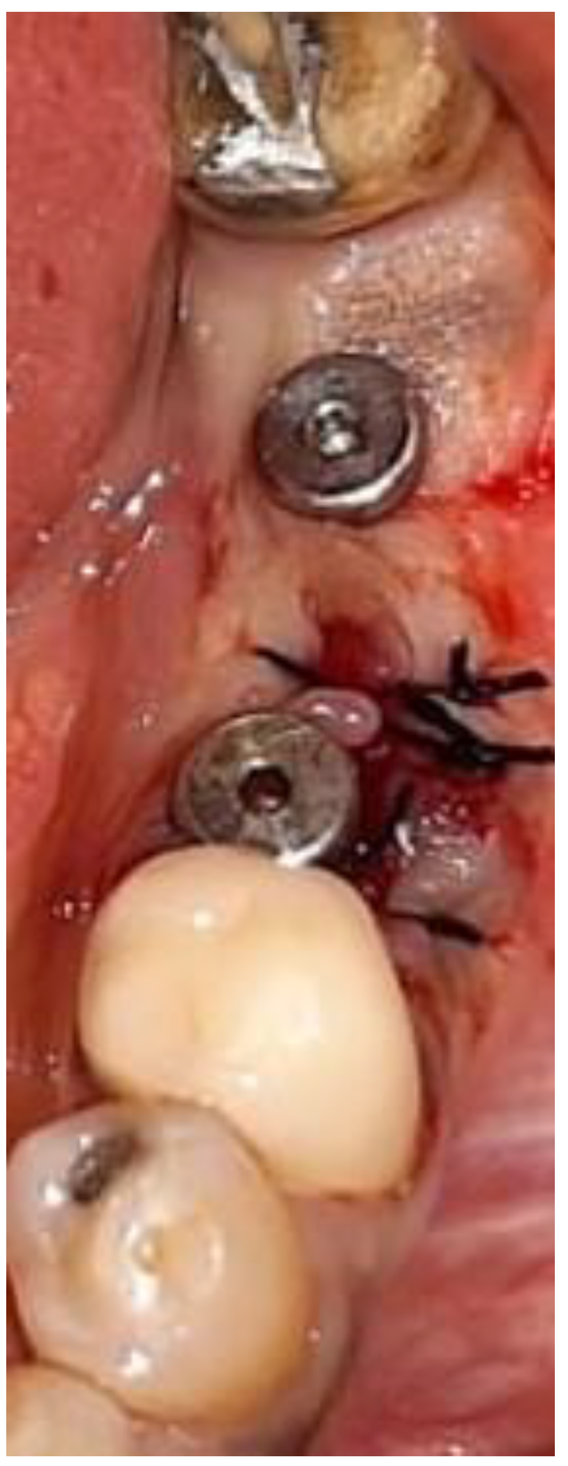 Medicina 57 00874 g007