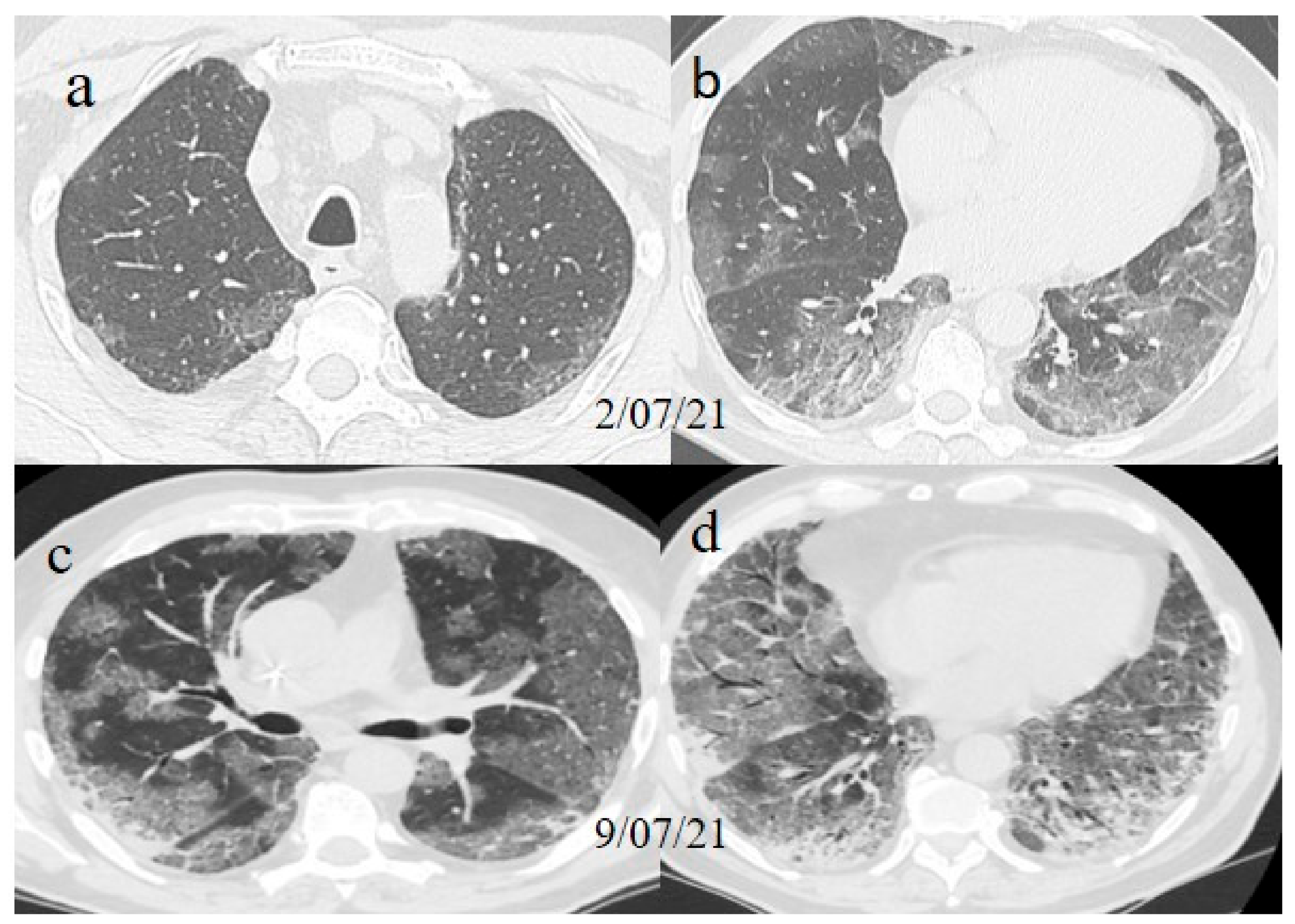 Medicina 57 00891 g001 550