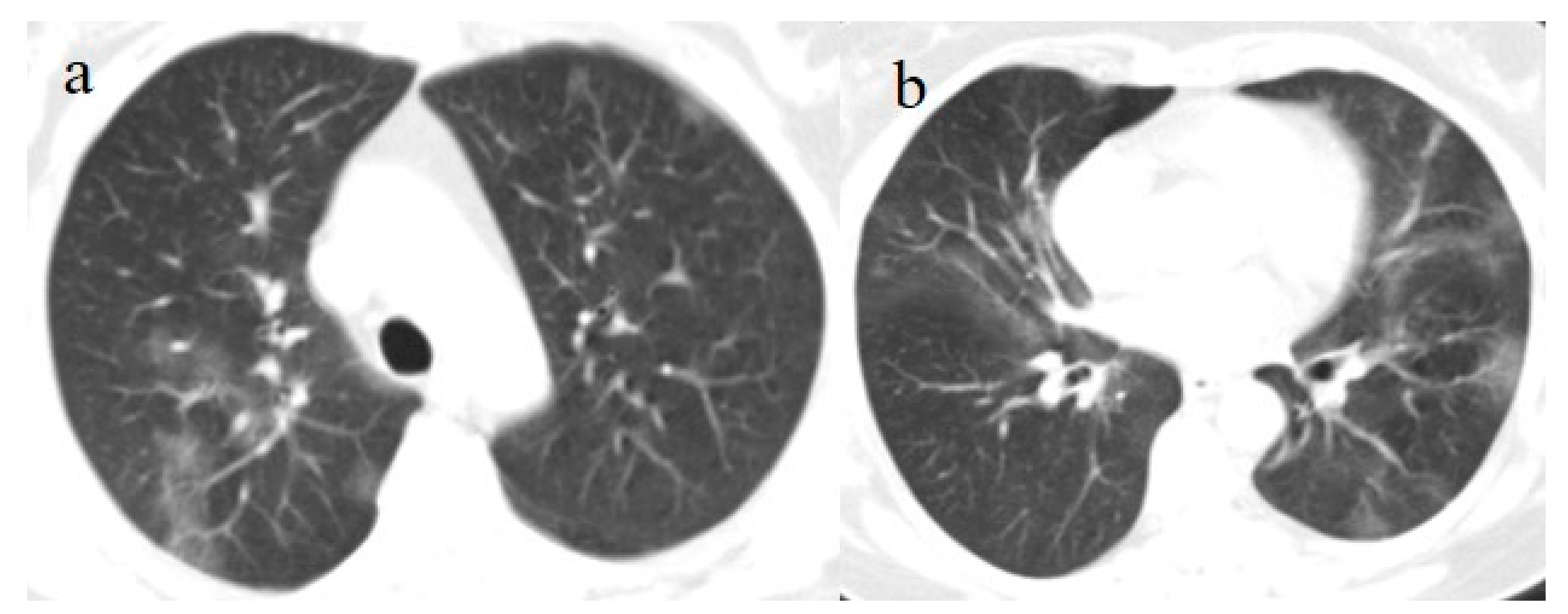 Medicina 57 00891 g004 550