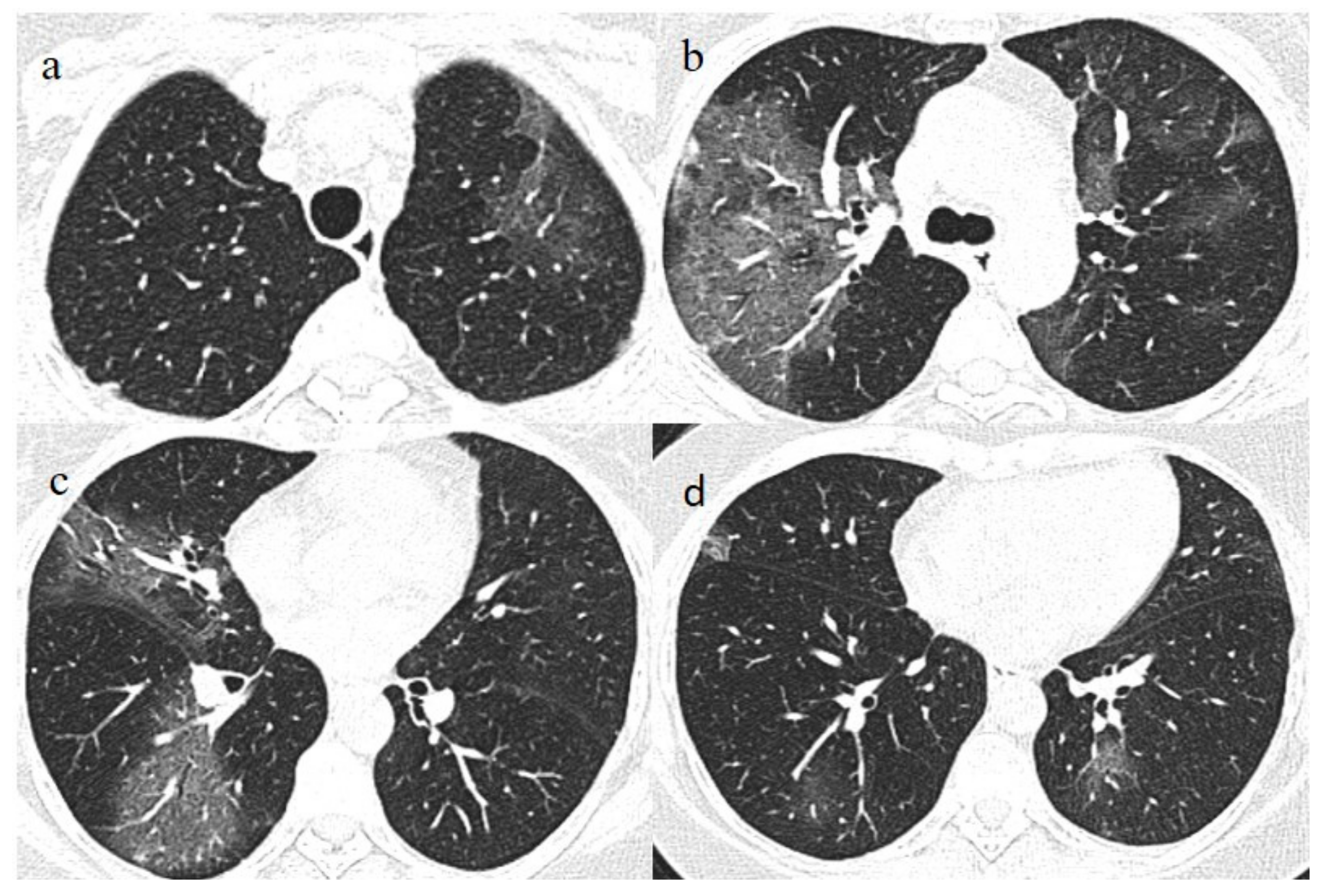 Medicina 57 00891 g005 550