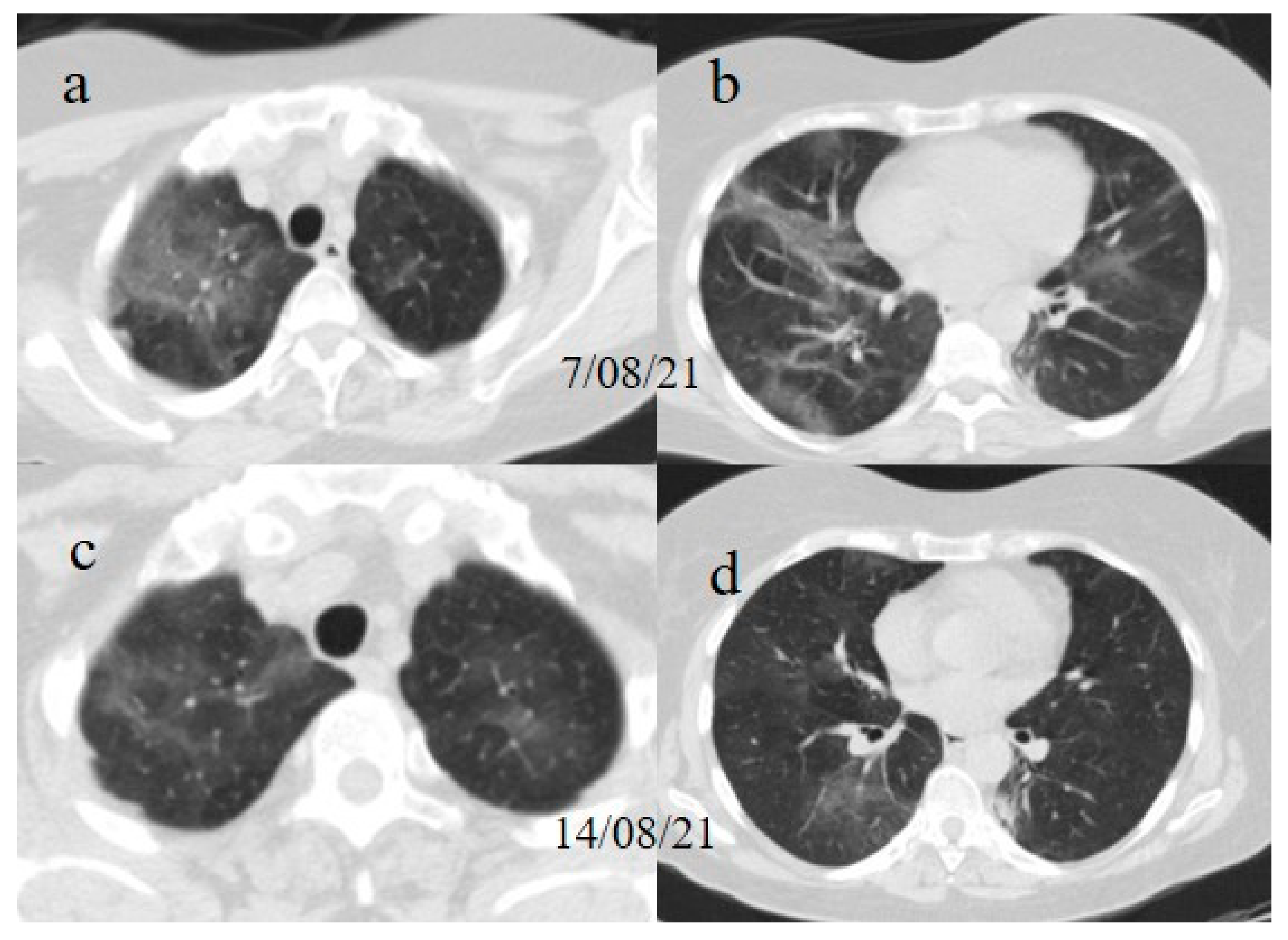 Medicina 57 00891 g007 550