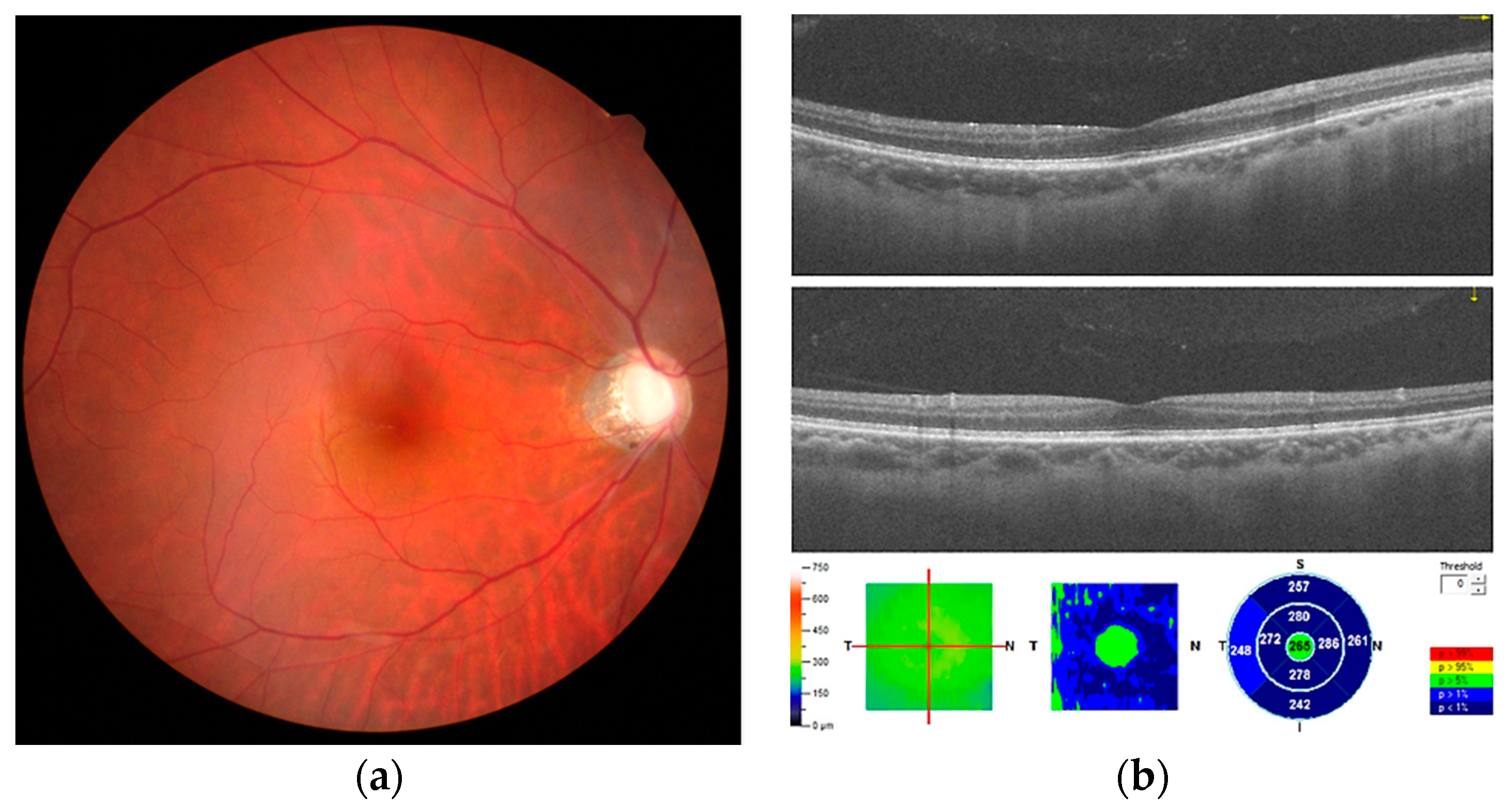 Medicina 57 00896 g002 550