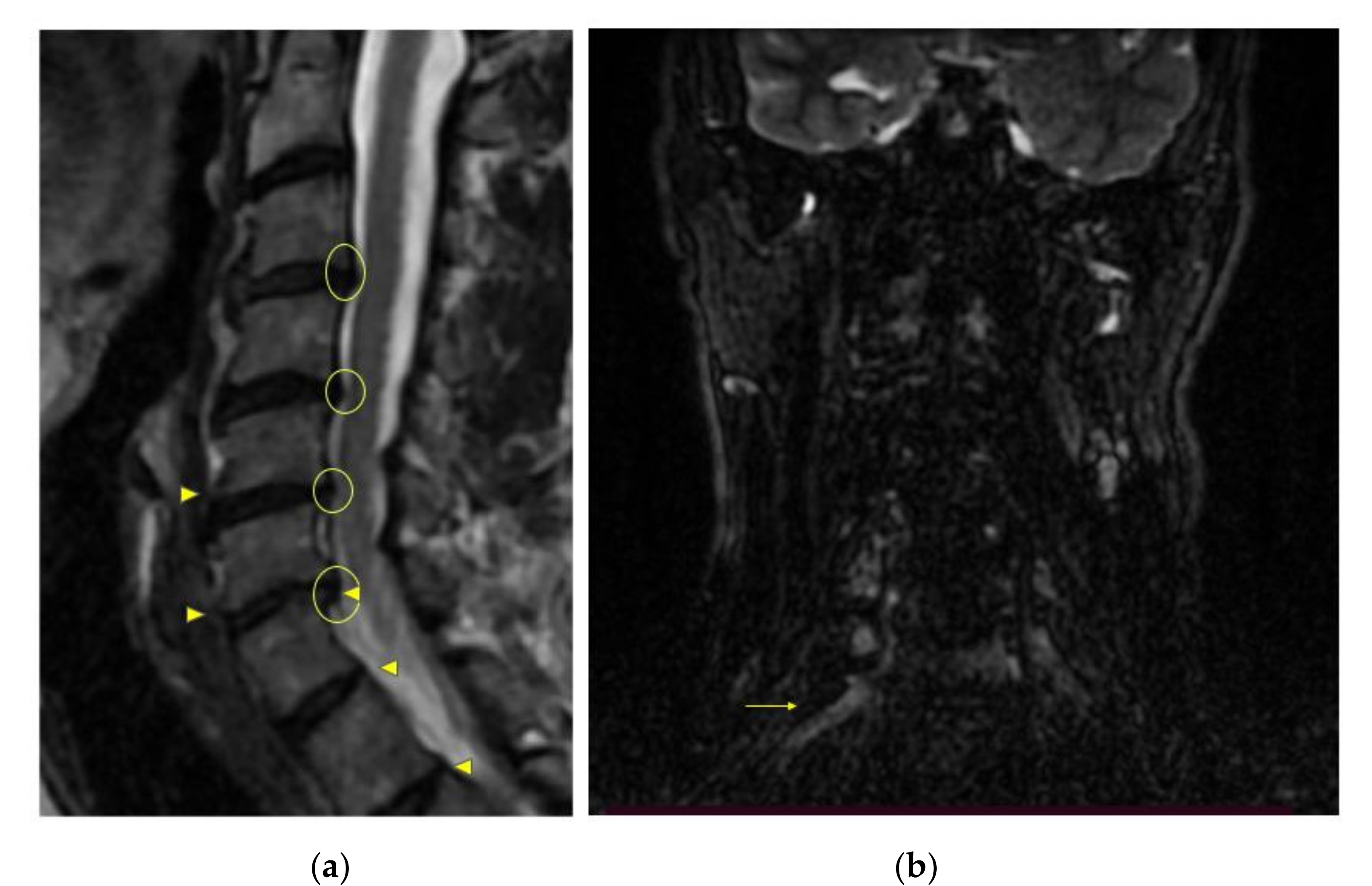 健康・医学 Thoracic Tumours PCS_NR_BT_PCLymphCompetent_01?