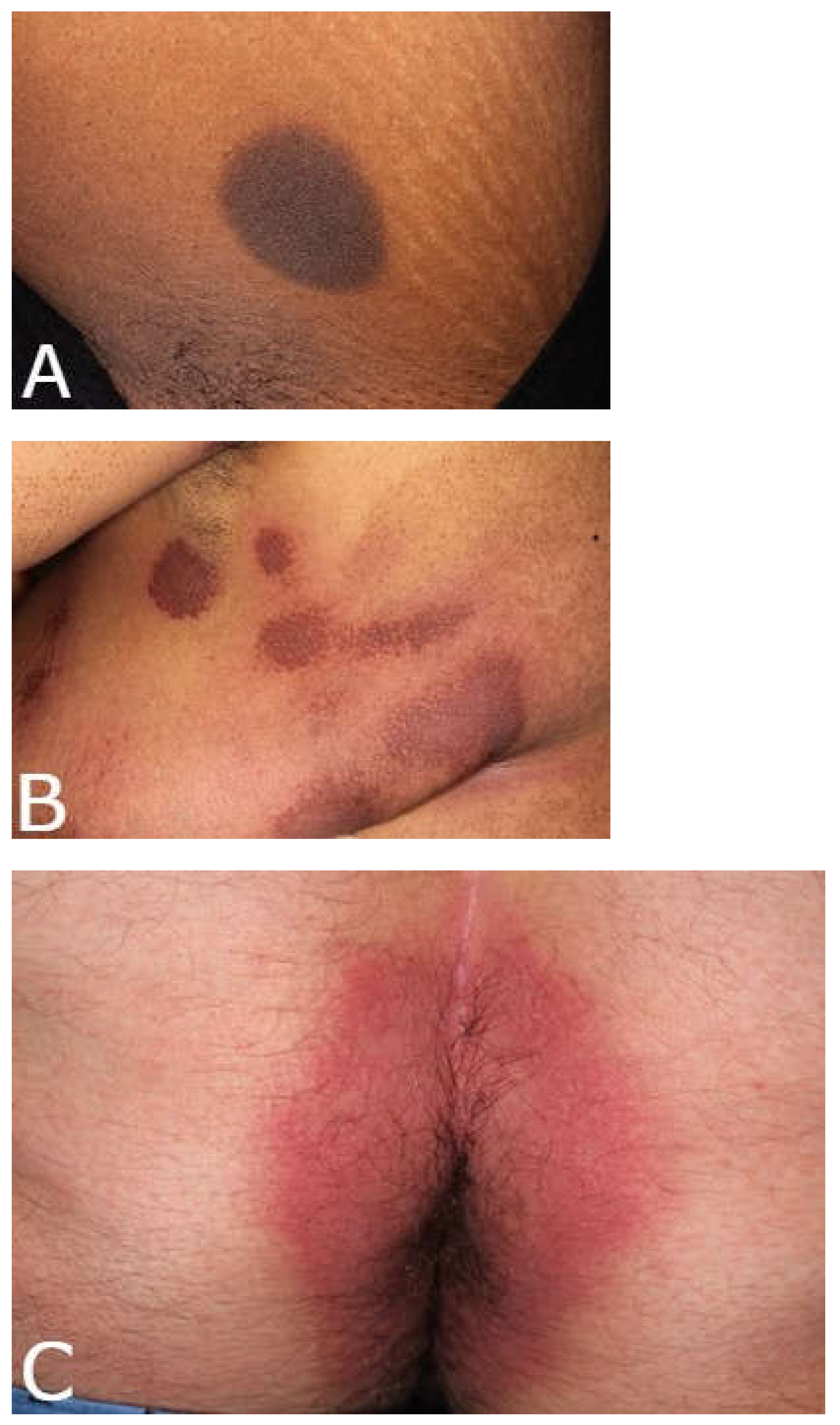 Medicina 57 00925 g001a