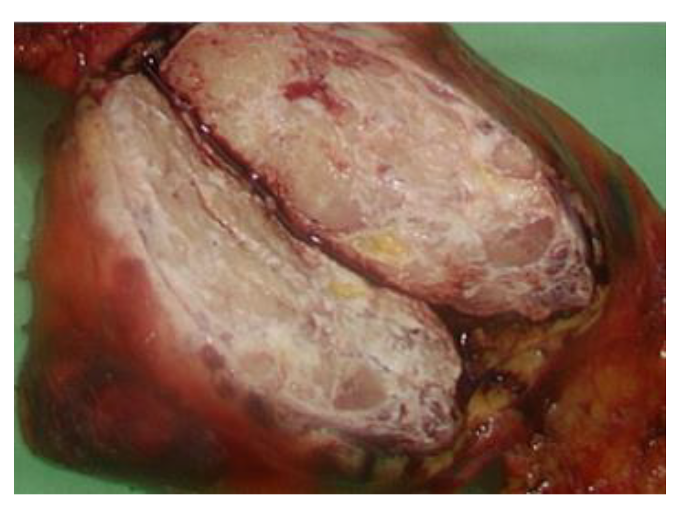 Medicina 57 00932 g004 550