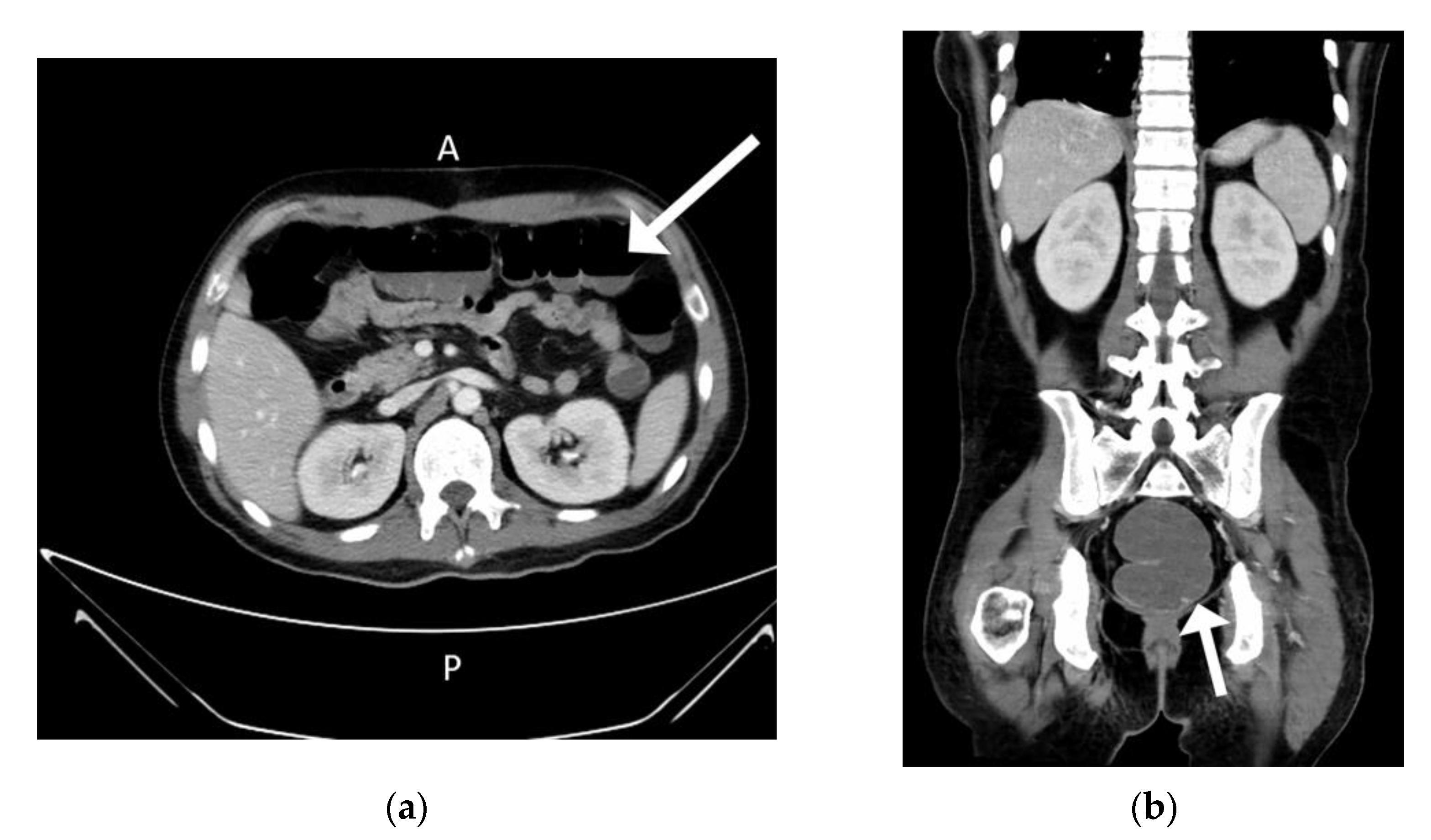 Medicina 57 00932 g006 550