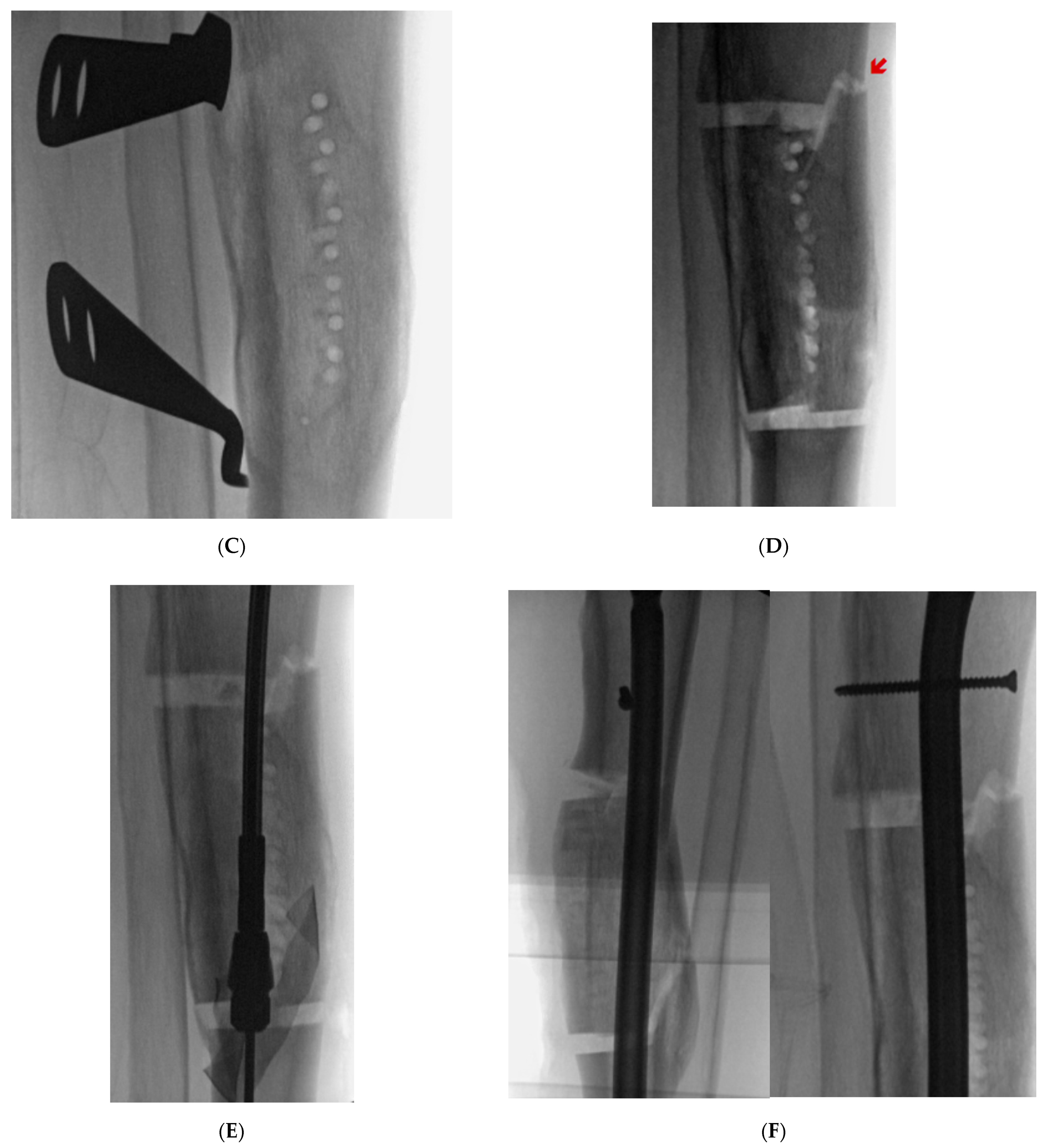 Medicina 57 00951 g004b 550