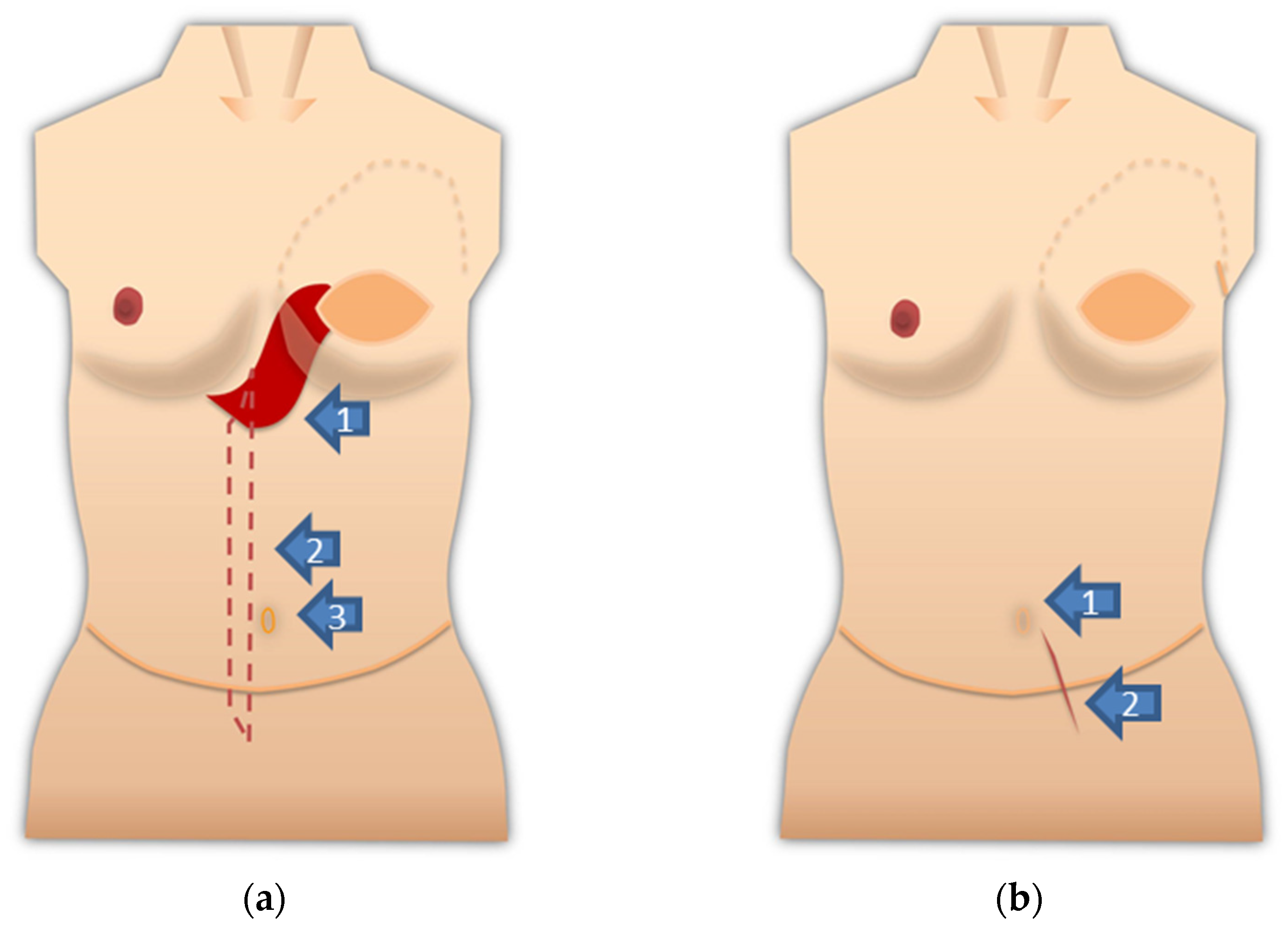 Medicina 57 00952 g002 550