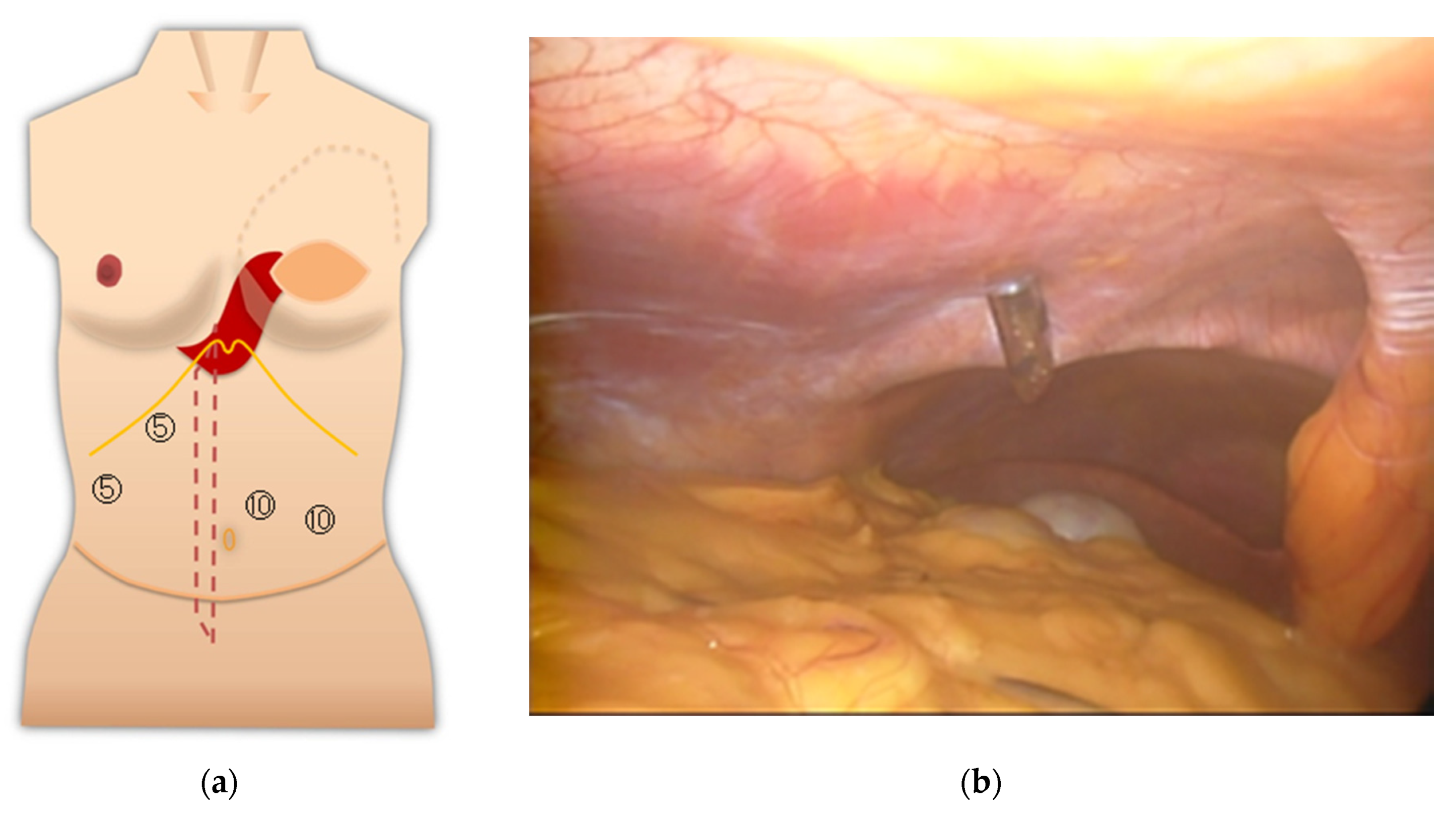Medicina 57 00952 g005 550