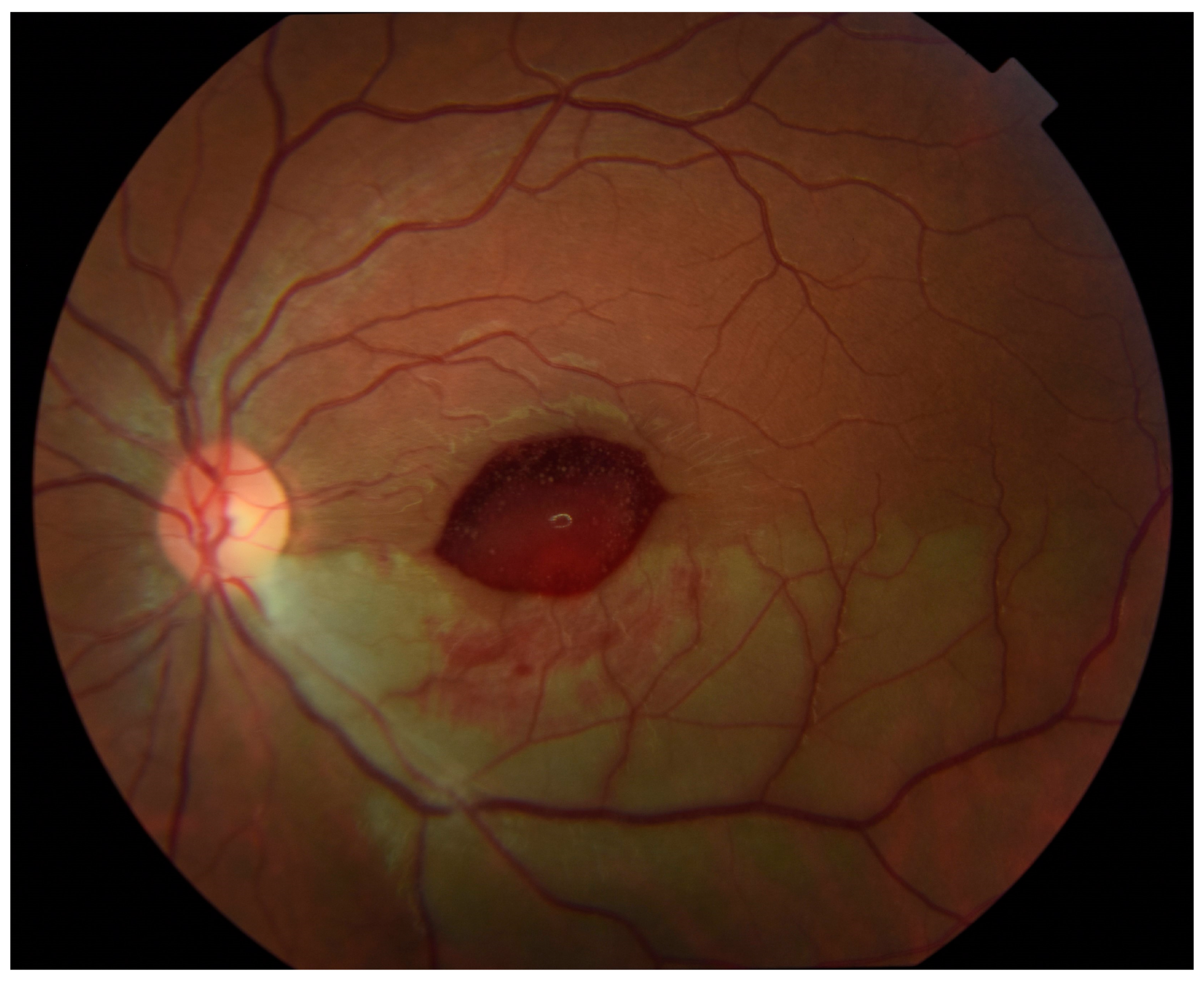 Medicina 57 00963 g003 550