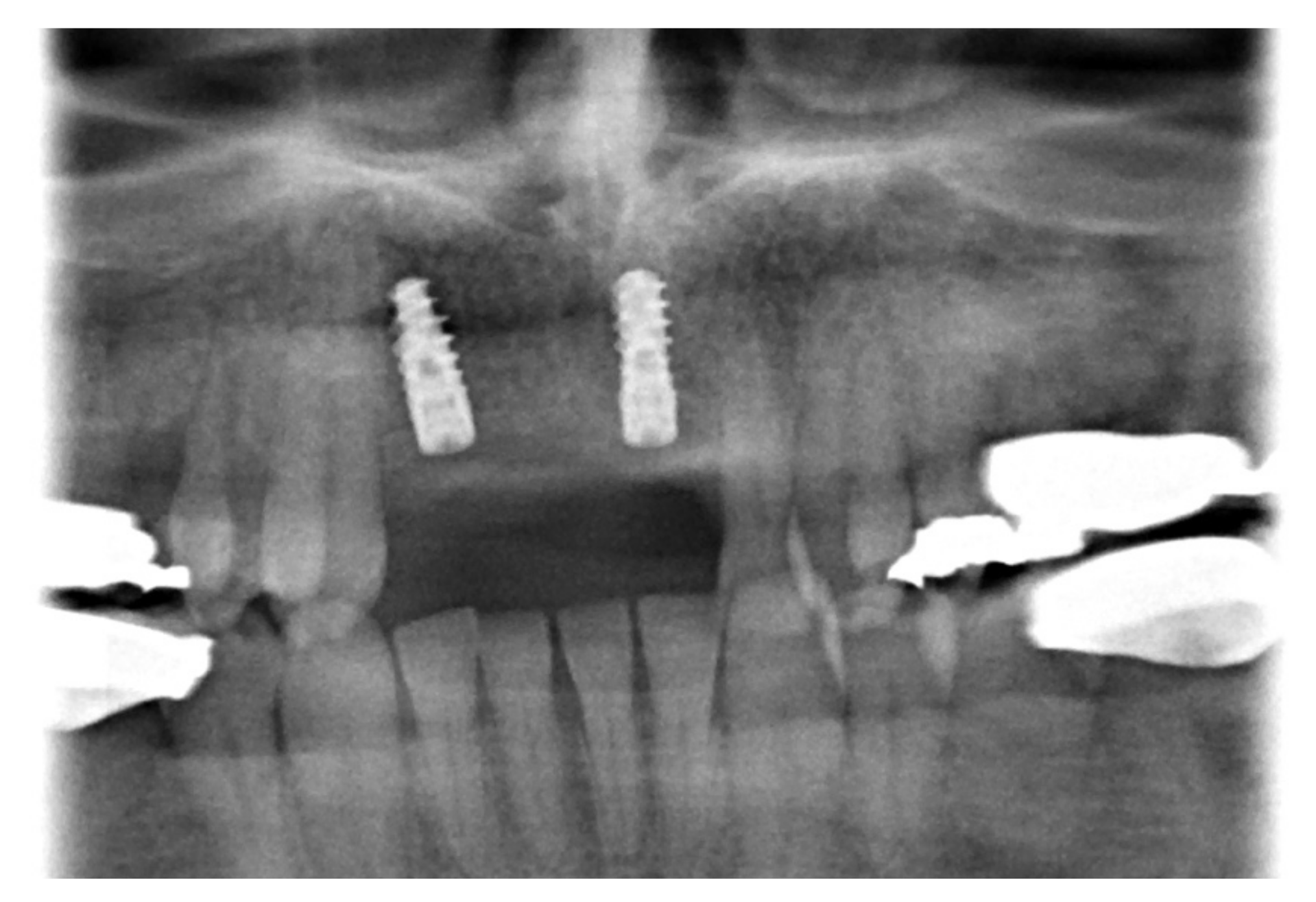 Medicina 57 00965 g005 550