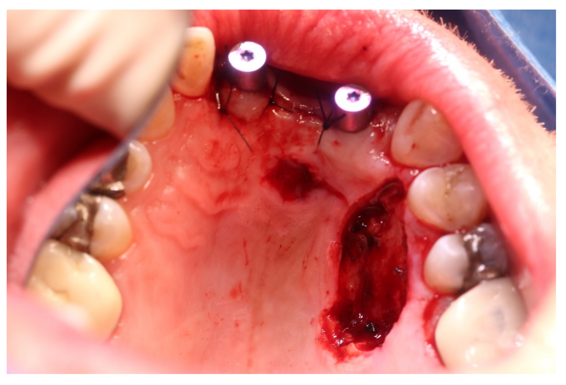 Medicina 57 00965 g007 550