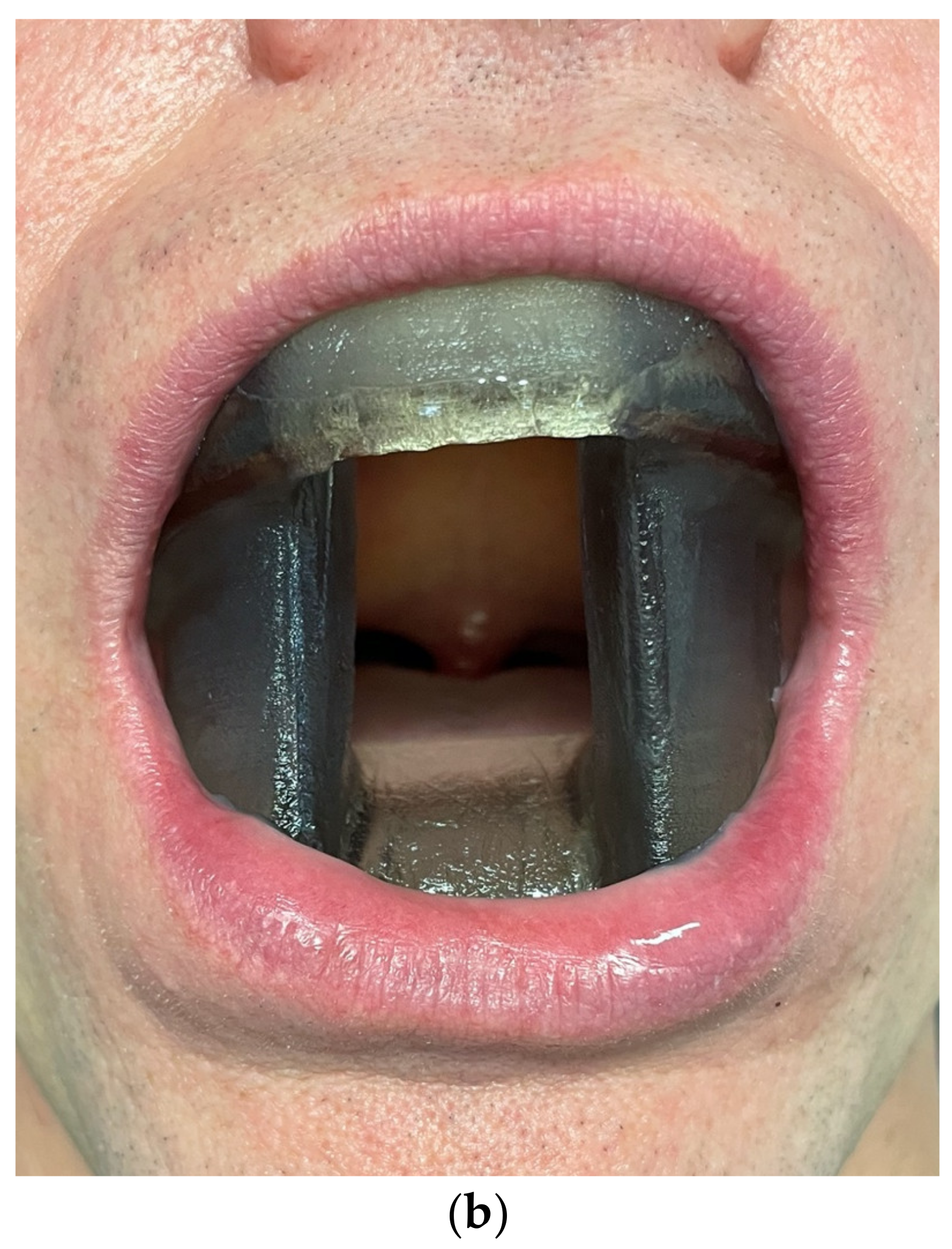 Medicina 57 00965 g009b 550