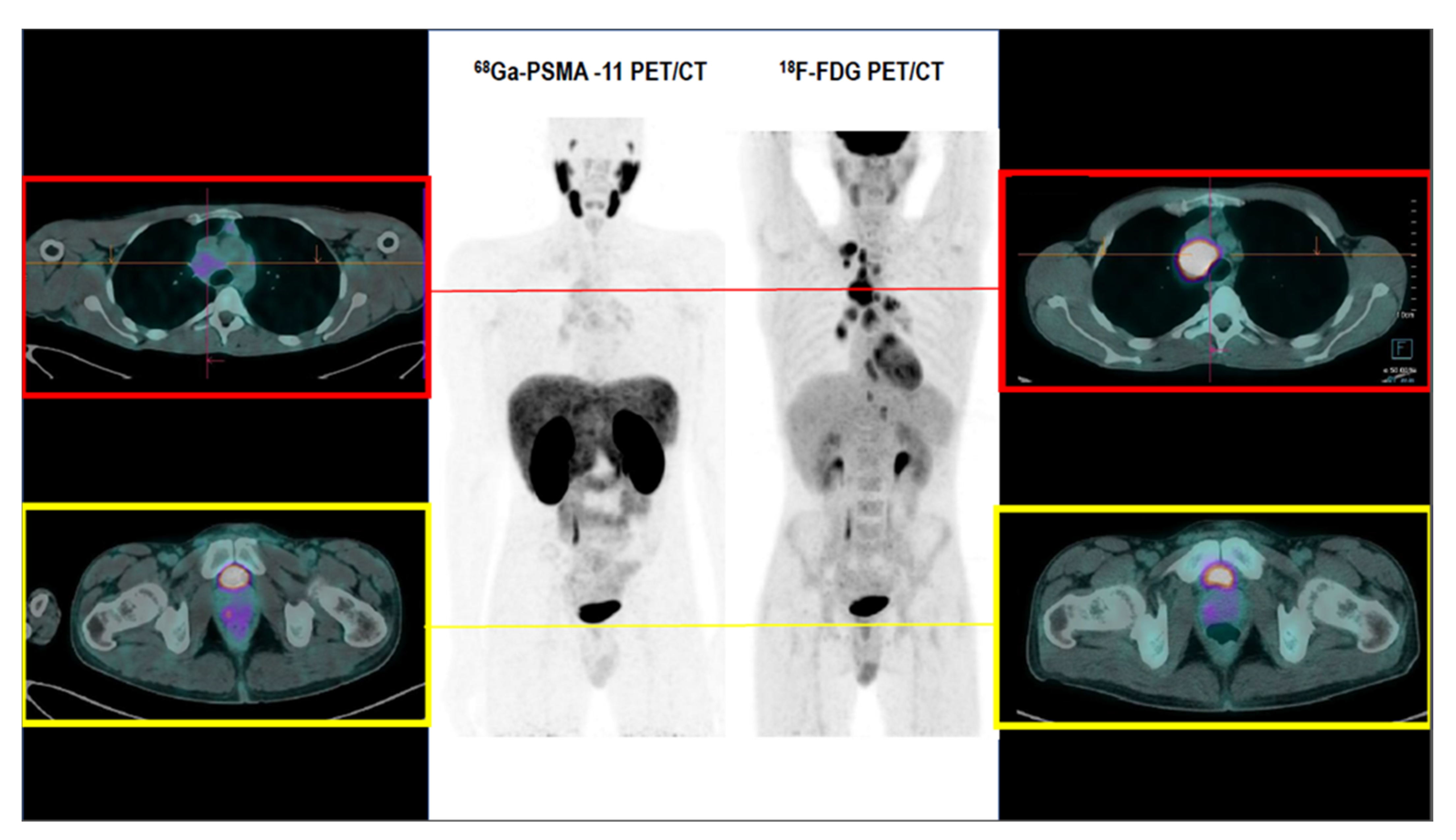 Medicina 57 00975 g001
