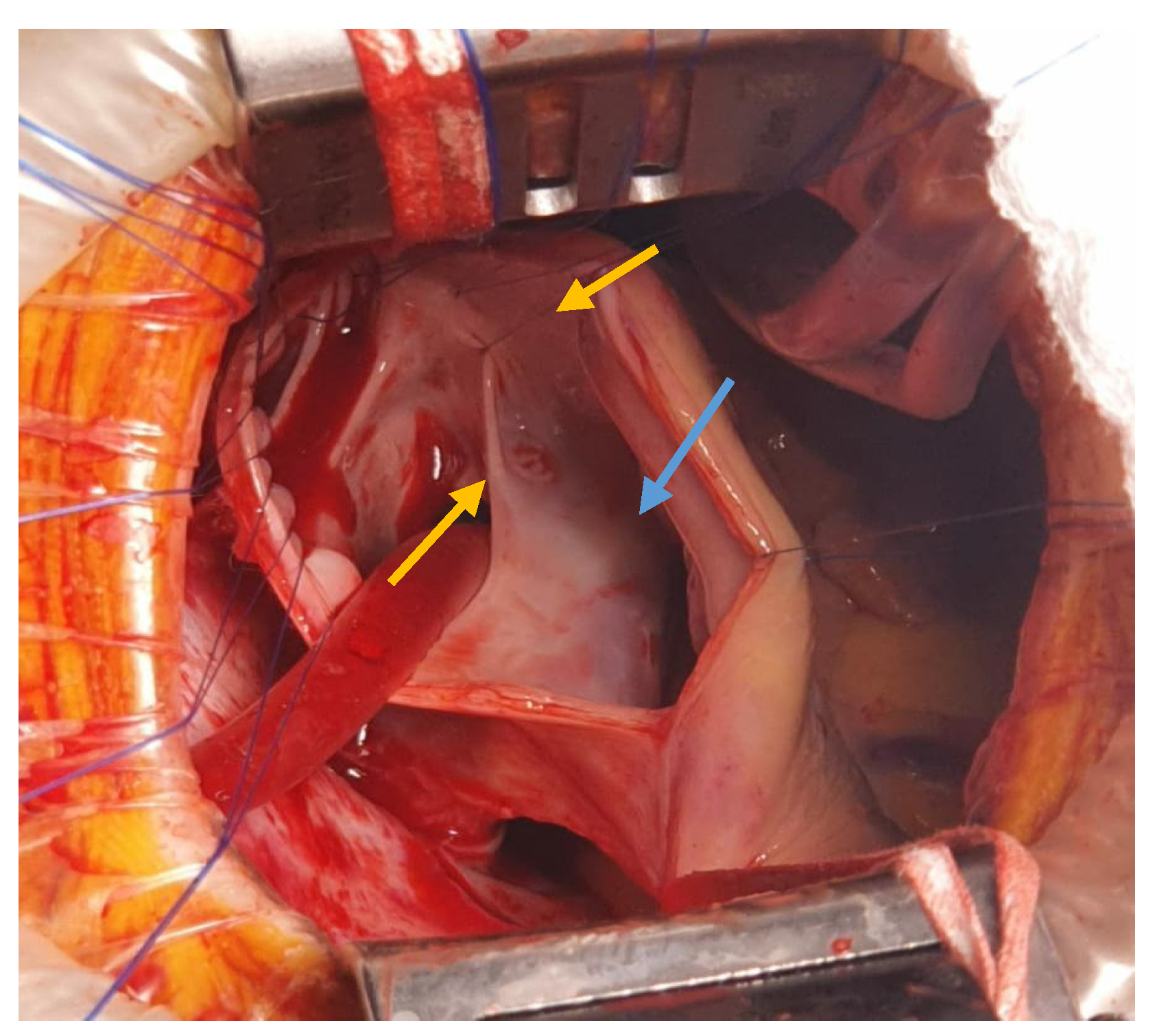 Medicina 57 00984 g004
