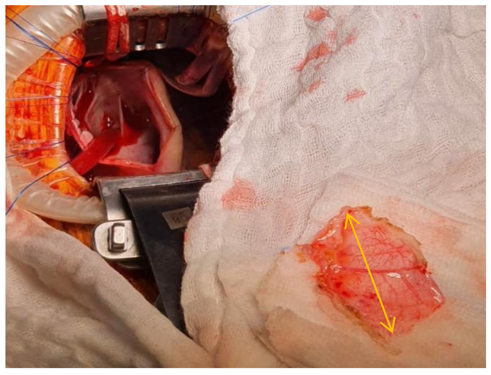 Medicina 57 00984 g005