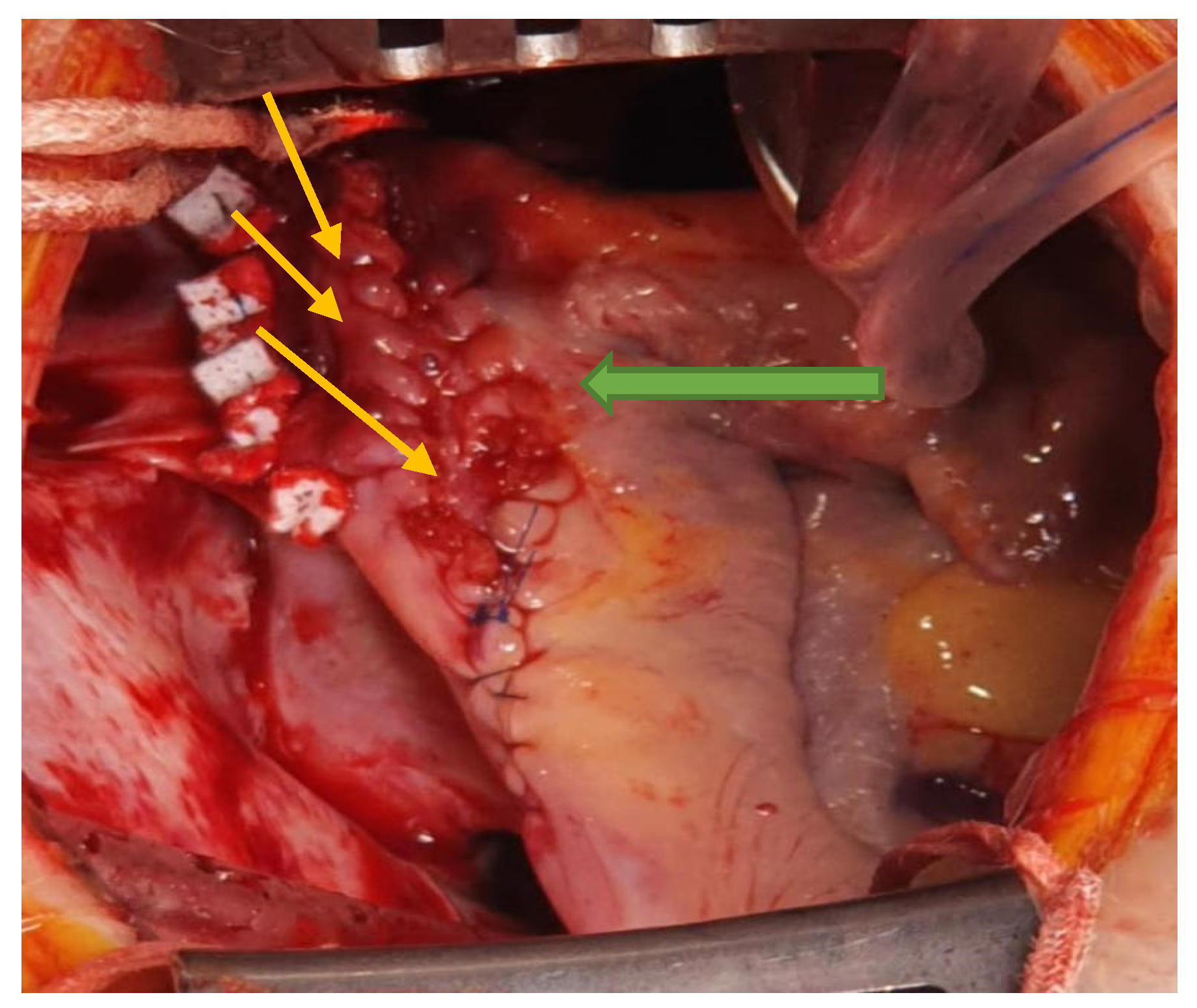 Medicina 57 00984 g006