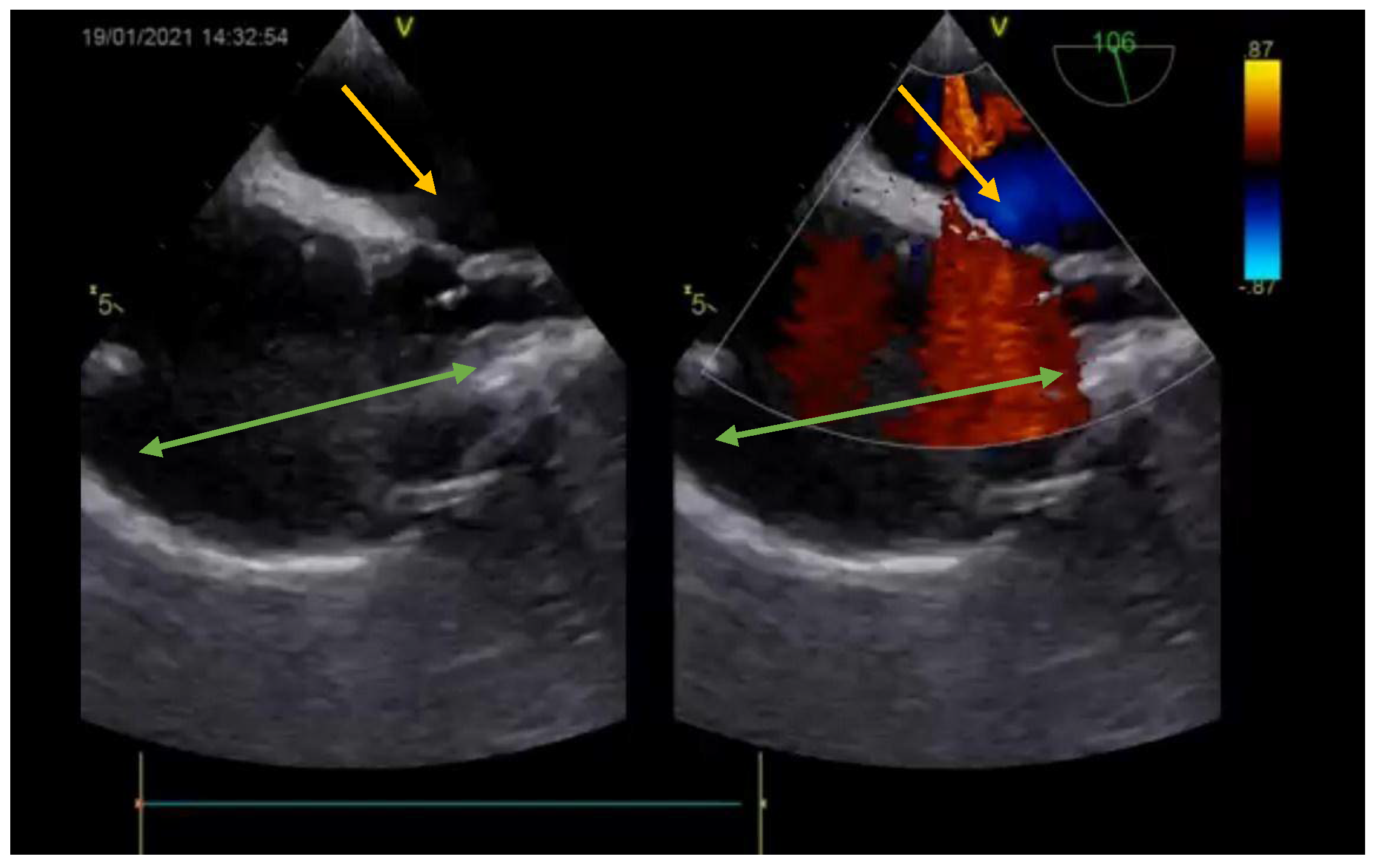 Medicina 57 00984 g008