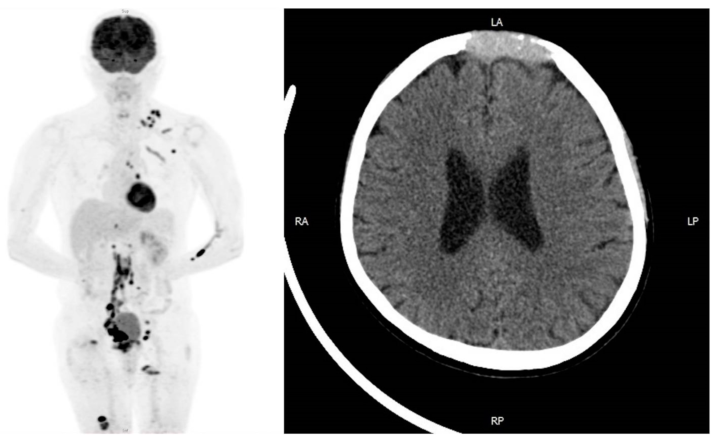 Medicina 57 00987 g001 550