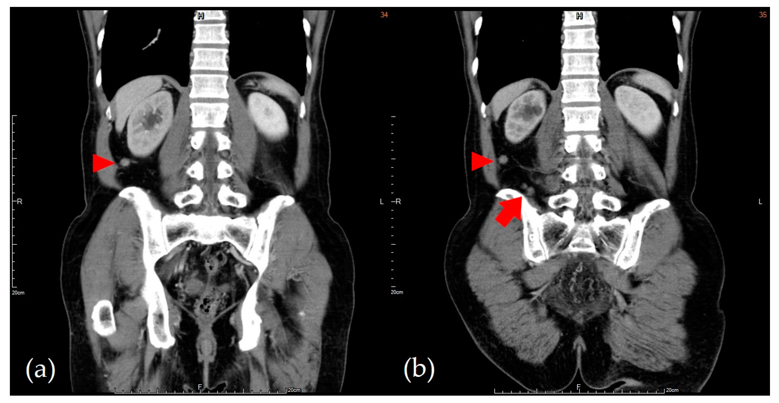 Medicina 57 00987 g002 550