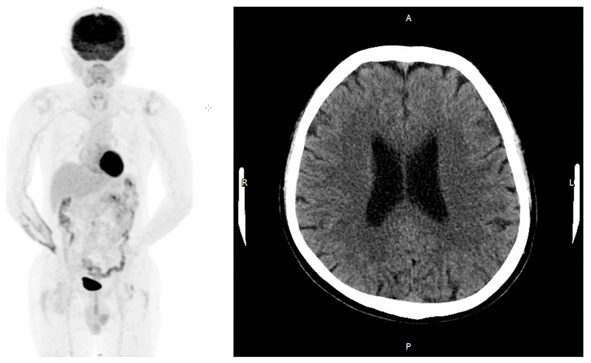 Medicina 57 00987 g003 550
