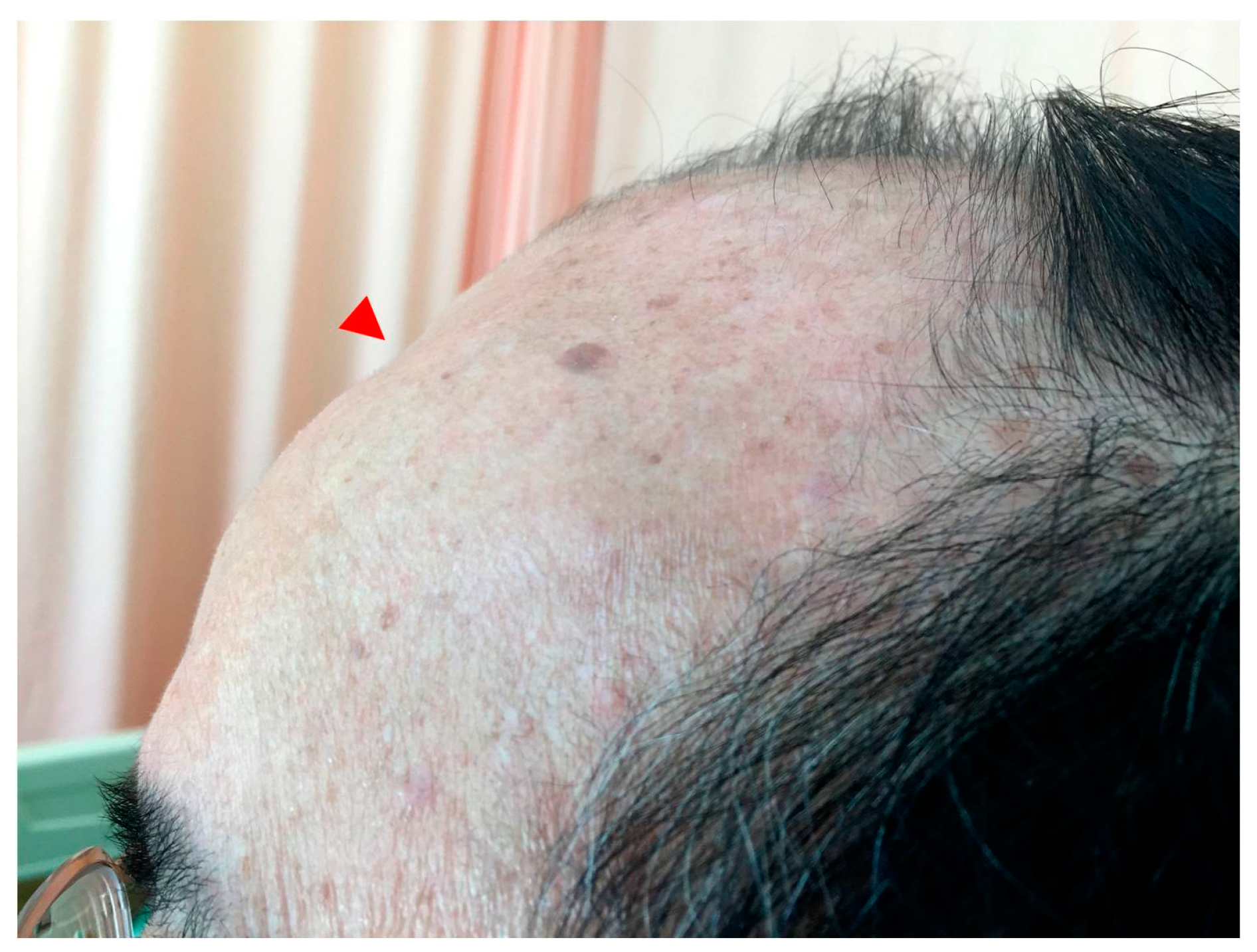 Medicina 57 00987 g004 550