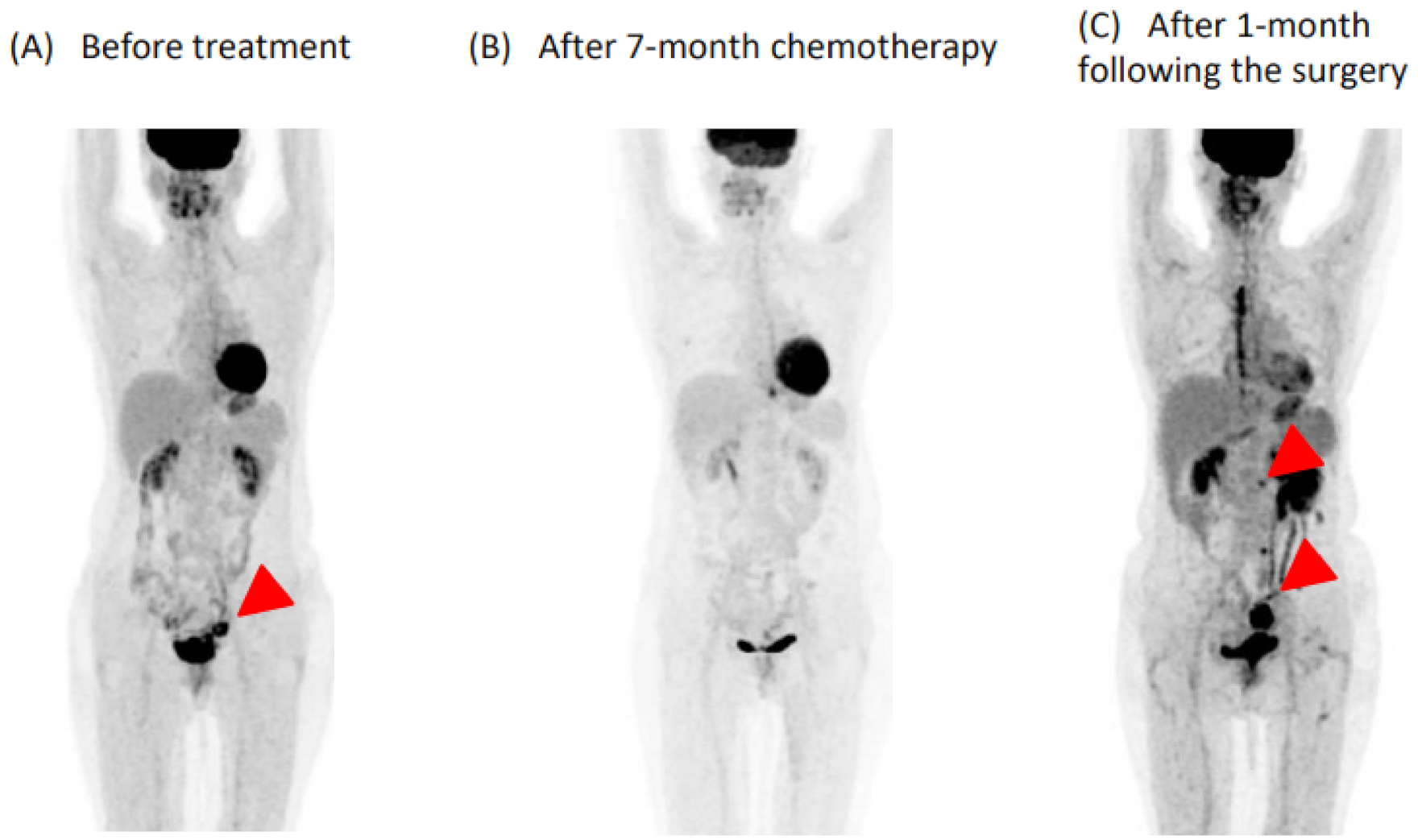 Medicina 57 00998 g001 550