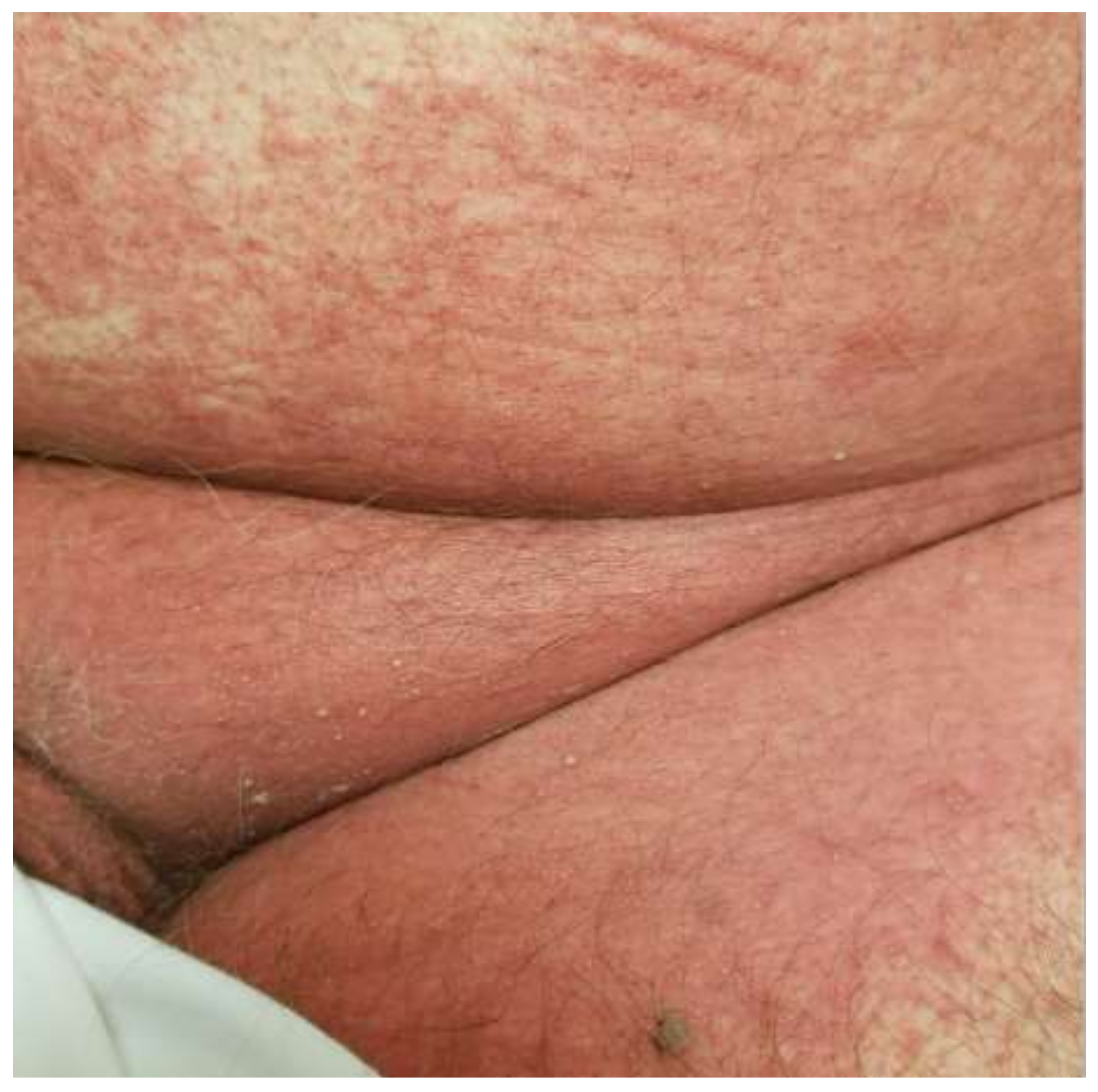 Medicina 57 01004 g002