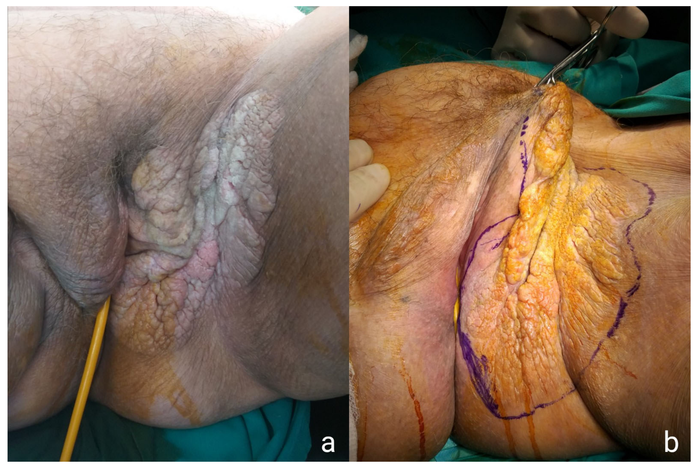 Medicina 57 01029 g001 550