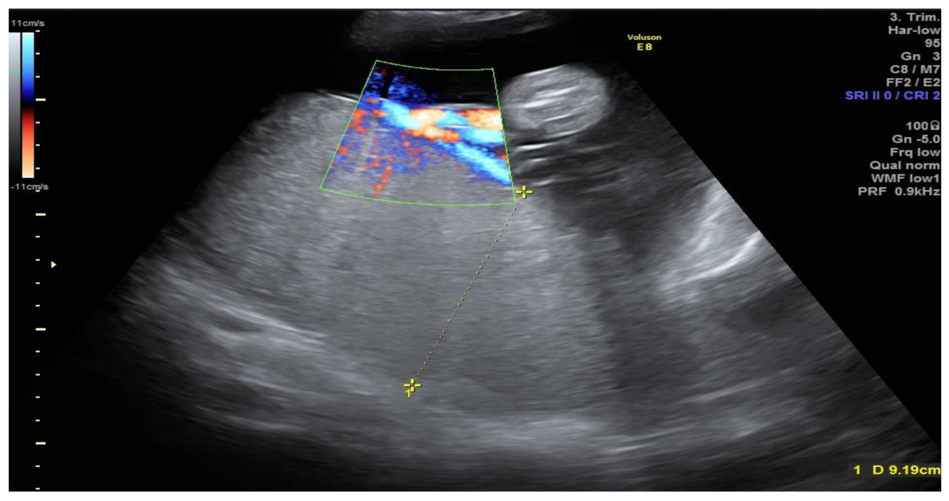Medicina 57 01031 g001