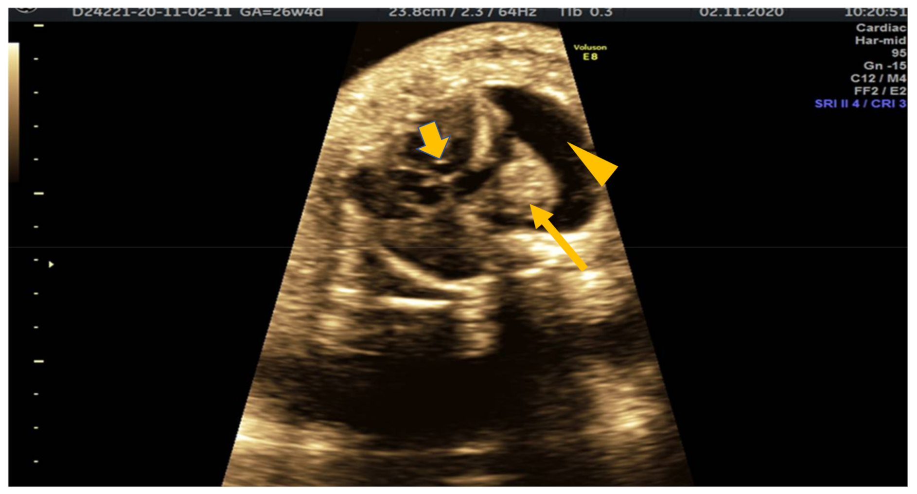 Medicina 57 01031 g002