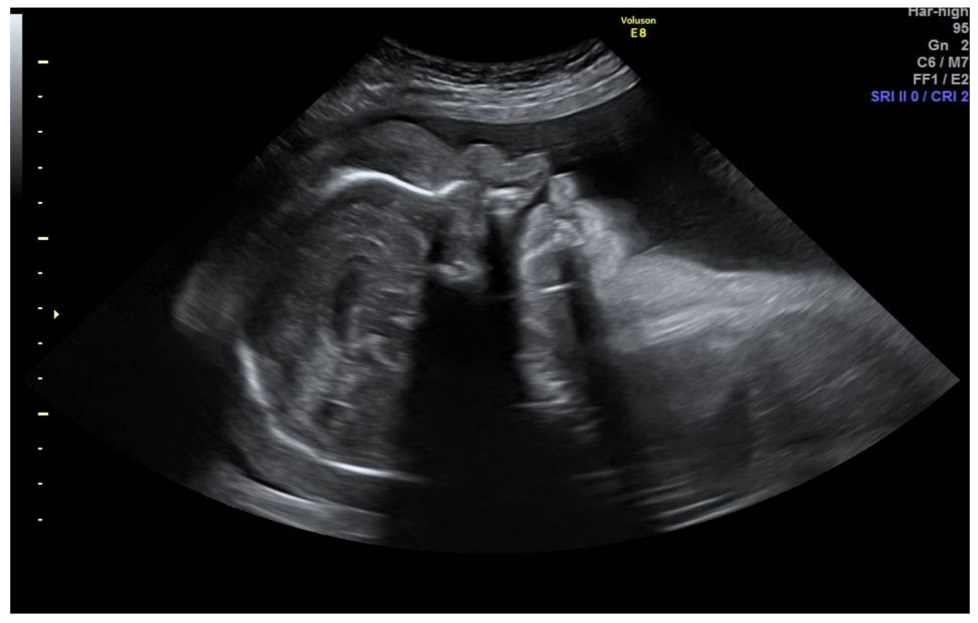 Medicina 57 01031 g003