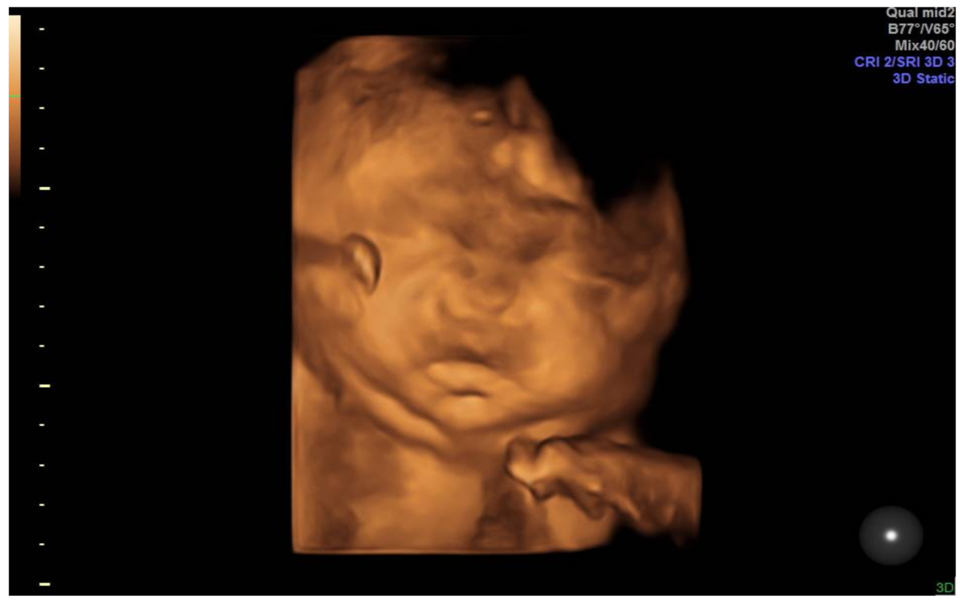 Medicina 57 01031 g004