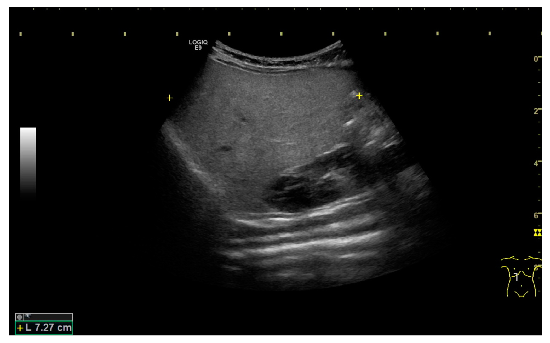 Medicina 57 01032 g004 550