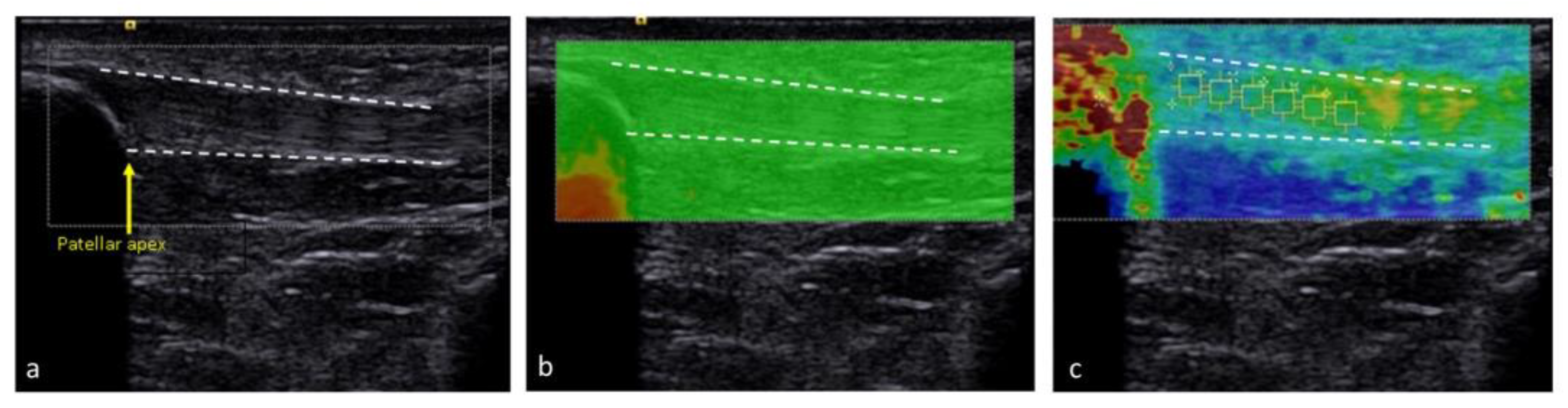Medicina 57 01037 g003 550