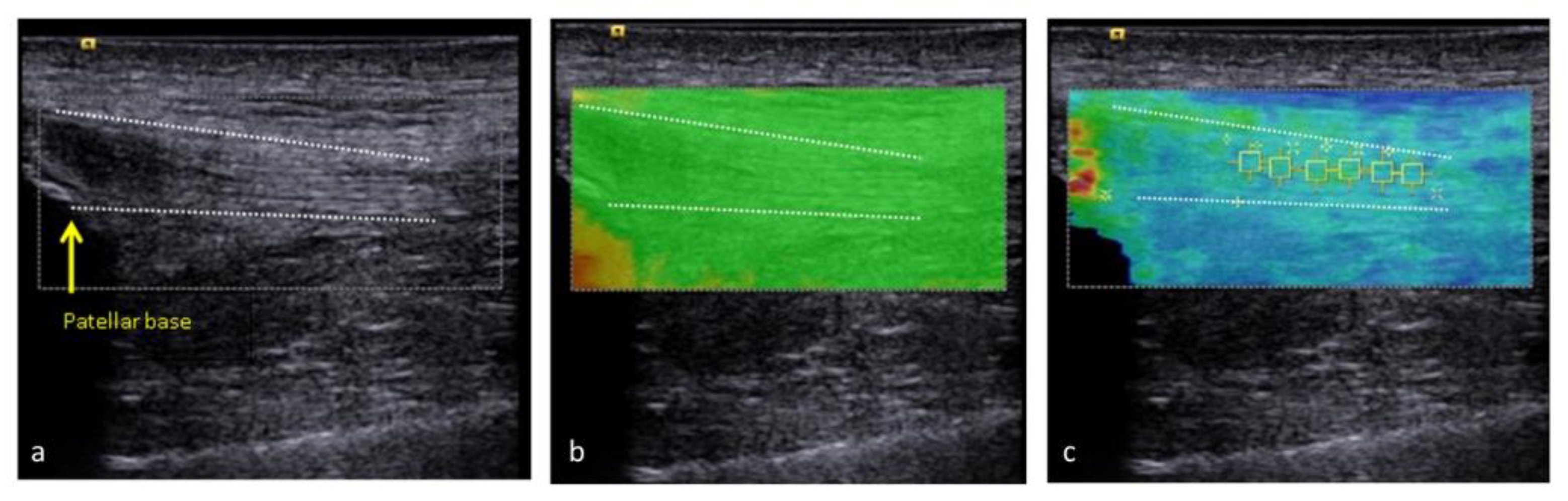 Medicina 57 01037 g004 550
