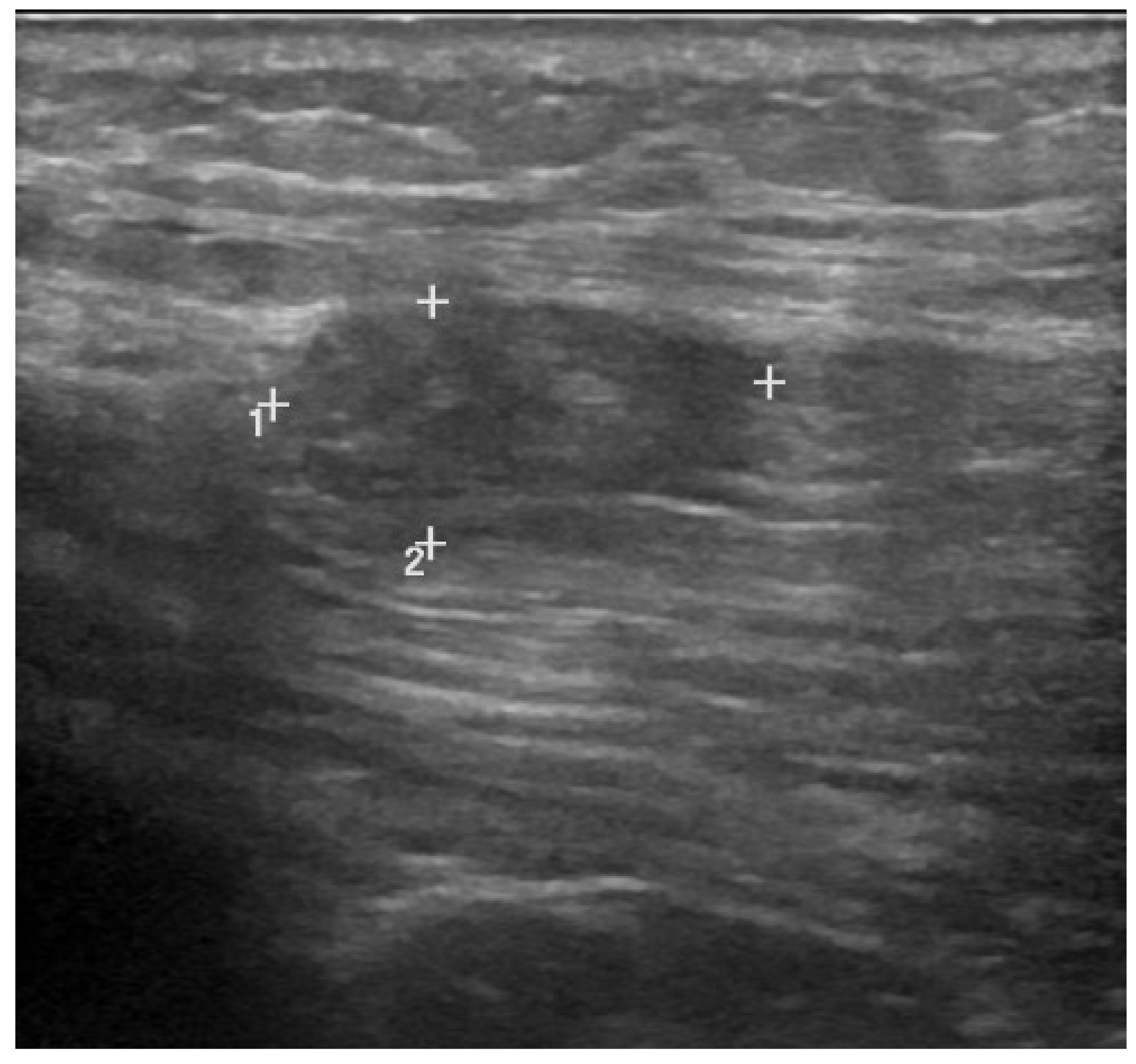 Medicina 57 01040 g003